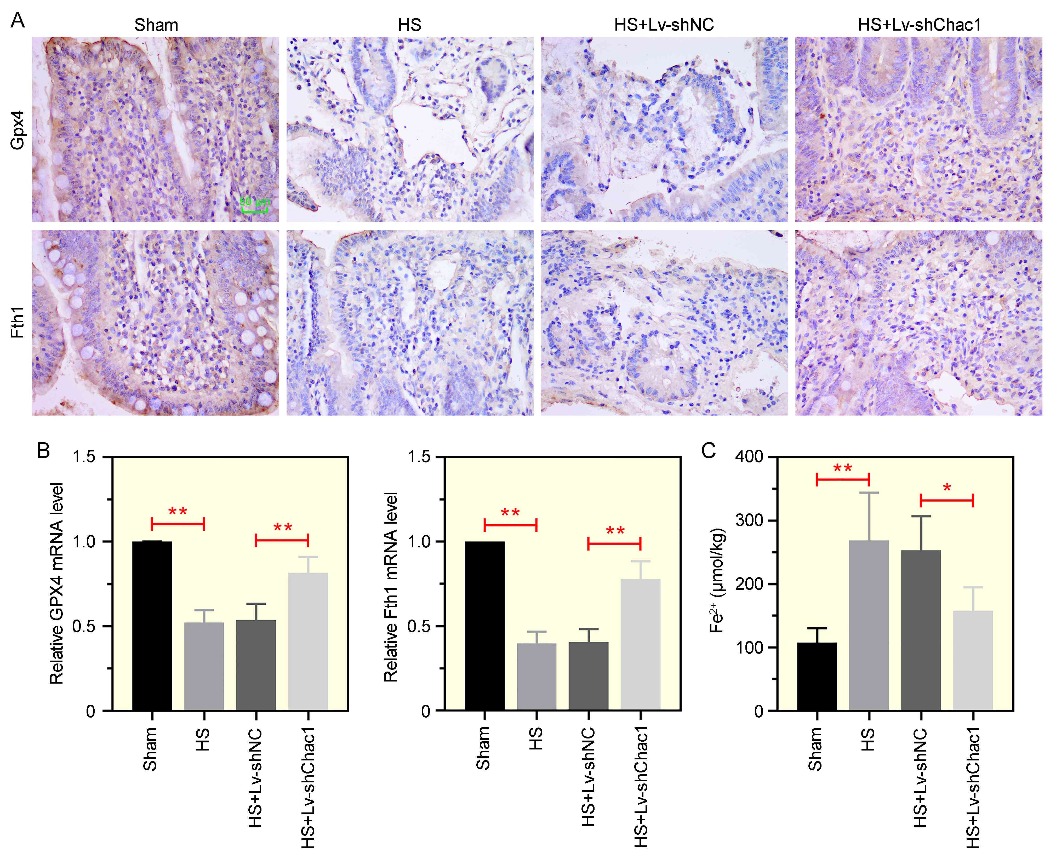 Ferroptosis induced by HS is ameliorated by inhibiting Chac1
expression in ileum tissues. (A) Immunohistochemistry staining to assess Gpx4
and Fth1 expression in ileum tissue. Scale bar: 50 µm. (B) Relative mRNA
levels of Gpx4 and Fth1 determined by RT-qPCR. (C) Measurement of iron content in
ileum tissue. *p < 0.05, **p < 0.01. Gpx4: glutathione
peroxidase 4; Fth1: ferritin heavy chain.