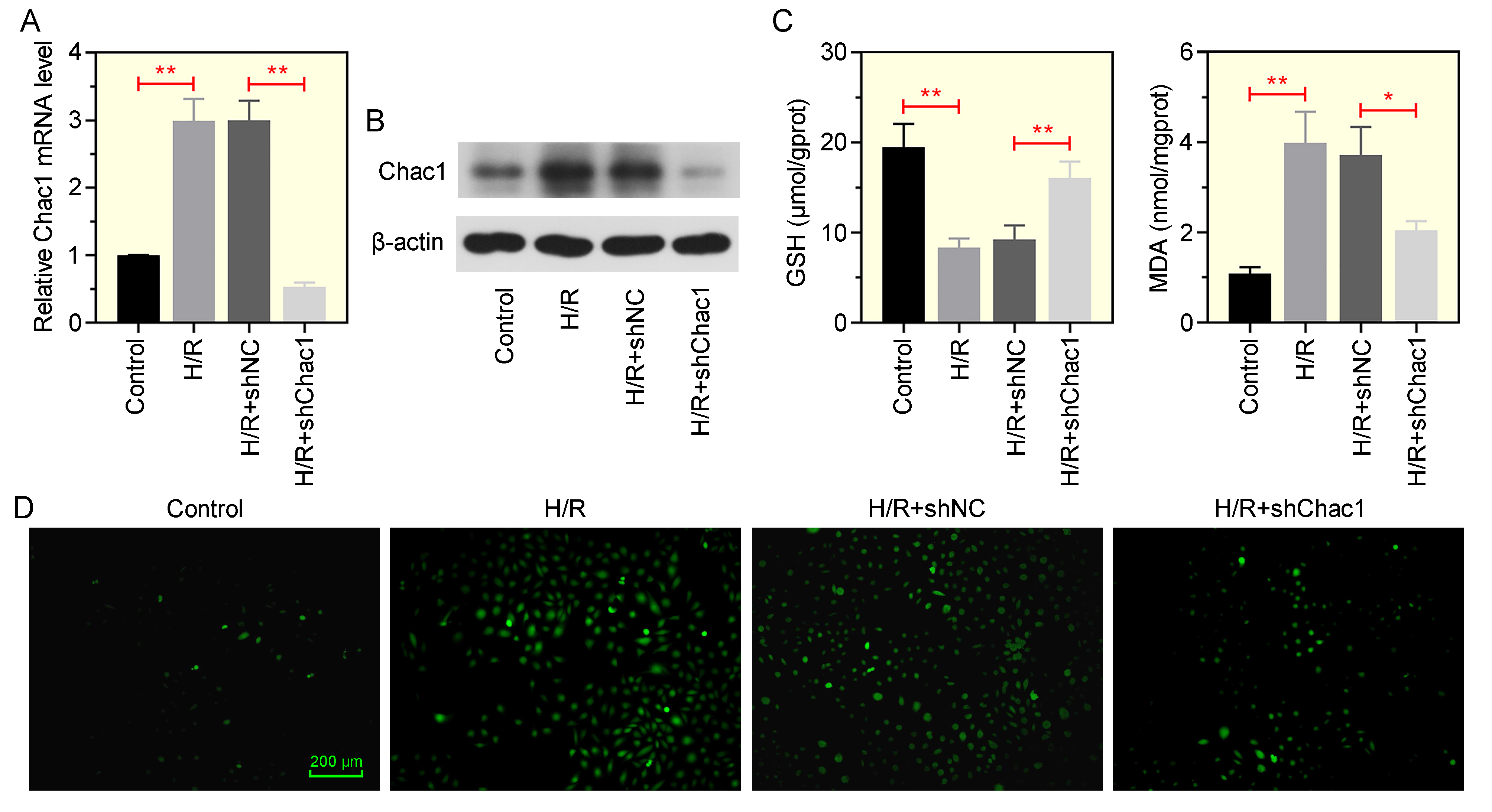 Silencing of Chac1 attenuates the oxidative stress induced by
H/R in IEC-6 cells. (A,B) Relative mRNA and protein expression of Chac1 in
H/R-treated IEC-6 cells. (C) Levels of GSH and MDA in IEC-6 cells. (D)
Immunofluorescence staining showing ROS levels marked by DCFH-DA in IEC-6 cells.
Scale bar: 200 µm. *p < 0.05, **p < 0.01. H/R:
hypoxia/reoxygenation; IEC-6: rat small intestine crypt epithelial cells; MDA:
malondialdehyde; GSH: glutathione; DCFH-DA: dichlorofluorescein diacetate; ROS:
reactive oxygen species.
