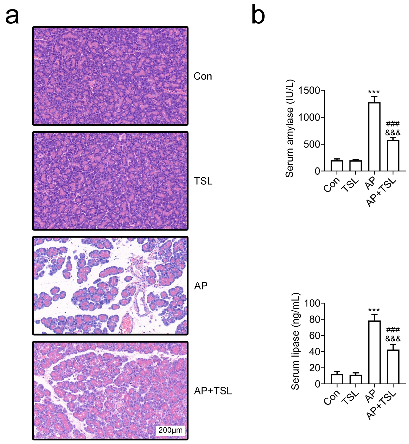 Tussilagone improved pathological changes in AP mice pancreatic
tissues. (a) Histopathological evaluation using H&E staining illustrating the
pancreatic tissue features in mice from the Control, TSL, Acute pancreatitis (AP)
and AP + TSL groups. (b) Serum amylase (top) and serum lipase (bottom) levels in
mice from the Control, TSL, AP and AP + TSL groups. ***p < 0.001, AP
vs. Con (control); ###p < 0.001, AP + TSL vs. TSL;
&&&p < 0.001, AP + TSL vs. AP. TSL: Tussilagone.