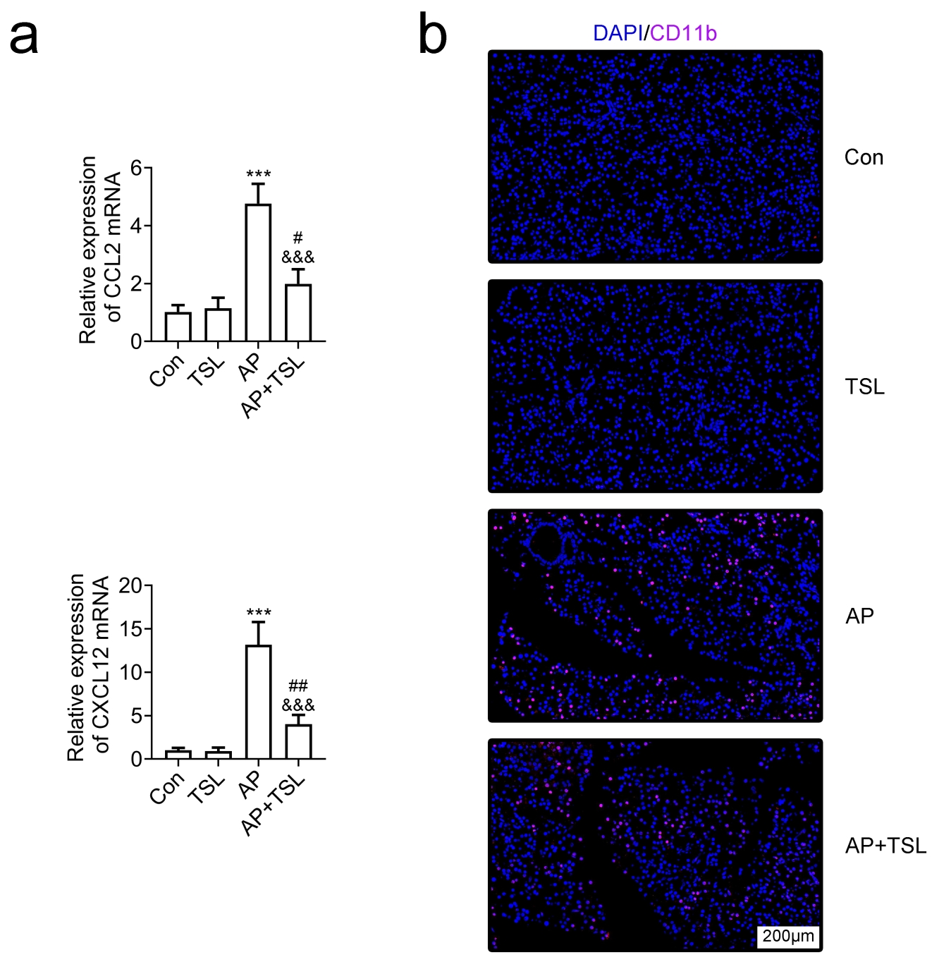 Tussilagone blocked neutrophil infiltration in the pancreatic
tissues of AP mice. (a) qPCR assay results showing the mRNA levels of CCL-2 and
CXCL12 in the pancreatic tissues of mice from the Control, TSL, Acute
pancreatitis (AP) and AP + TSL groups. (b) Immunofluorescence assay results of
the expression of CD11b (red panel) and DAPI in pancreatic tissues of mice from
the Control, TSL, AP and AP + TSL groups. ***p < 0.001, AP
vs. Con (control); #p < 0.05, ##p < 0.01, AP +
TSL vs. TSL; &&&p < 0.001, AP + TSL vs. AP. TSL:
Tussilagone; CCL: chemokine C-C-motif ligand; CXCL: chemokine C-X-C-motif ligand;
DAPI: 4,6-diamino-2-phenyl indole; CD11b: cluster of differentiation 11b.