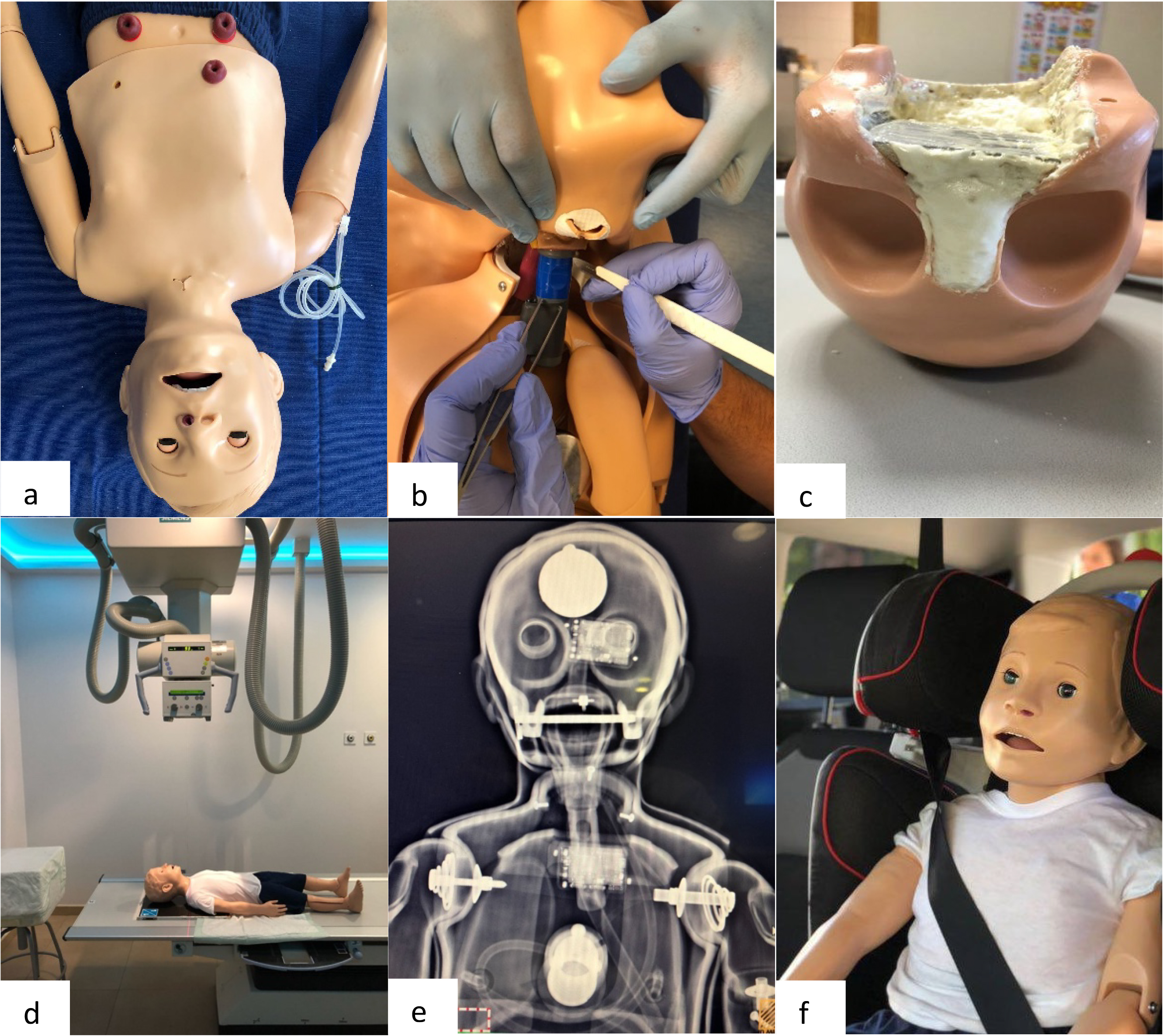 Process of modification and adaptation of the simulator. (a)
simulator selection; (b) modification of neck mobility; (c) adaptation of the
head to 1 kg in weight; (d) anteroposterior radiograph of the device; (e) result
of the adaptation of the device; (f) final result of the adapted simulator.