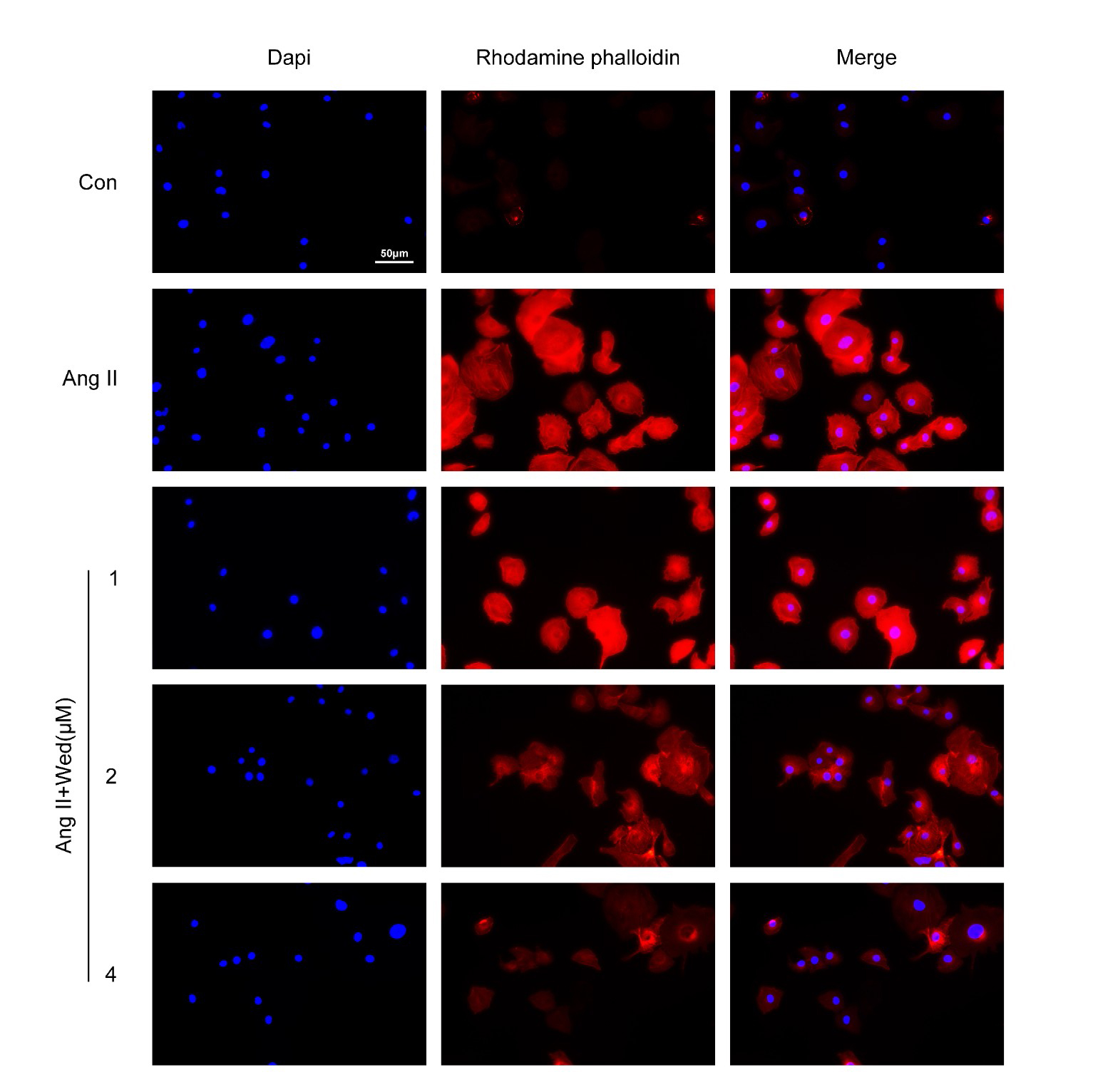 Wedelolactone further restrained the progression of Ang
II-stimulated cardiomyocyte hypertrophy. Phalloidin staining assays showed the
staining degree of phalloidin in H9C2 cells upon Ang II treatment and
Wedelolactone (Wed) treatment at the concentration of 1, 2 and 4 μM for 24
h. Red panel indicates phalloidin. Ang II, Angiotensin II; Con, Control.