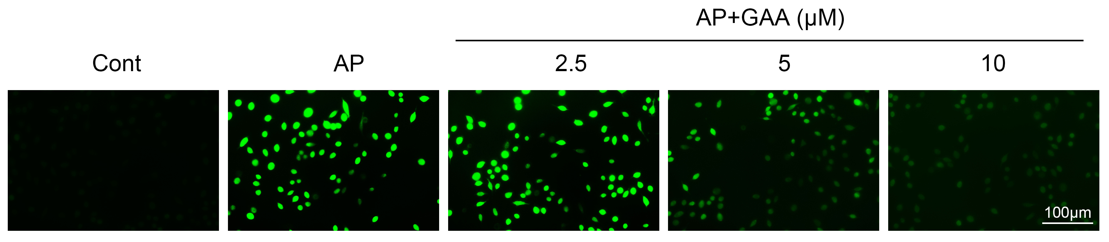 GAA mitigated oxidative stress by decreasing ROS production in
caerulein-stimulated AR42J cells. Immunostaining assays showed ROS levels of
AR42J cells upon GAA treatment at concentrations of 2.5, 5 and 10 µM and
caerulein for 24 h. Green panel indicates ROS levels. Scale bar, 100 µm.
AP, acute pancreatitis; GAA, Ganoderic acid A.