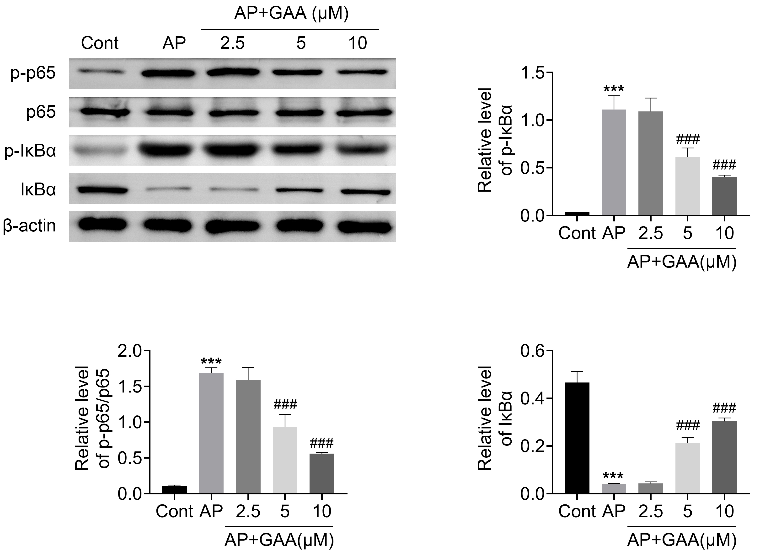 GAA inhibited the NF-κB pathway in caerulein-stimulated
AR42J cells. Immunoblot assays showed p65 and IκBα expressions
and phosphorylation levels of in AR42J cells upon GAA treatment at concentrations
of 2.5, 5 and 10 µM and caerulein for 24 h. The relative expression of
IκBα and relative phosphorylation levels of p65 and
IκBα were quantified. ***p < 0.001,
Caerulein (AP) vs. control, ###p < 0.001, AP + GAA
vs. AP. AP, acute pancreatitis; GAA, Ganoderic acid A;
IκBα, NF-kappa-B inhibitor alpha.