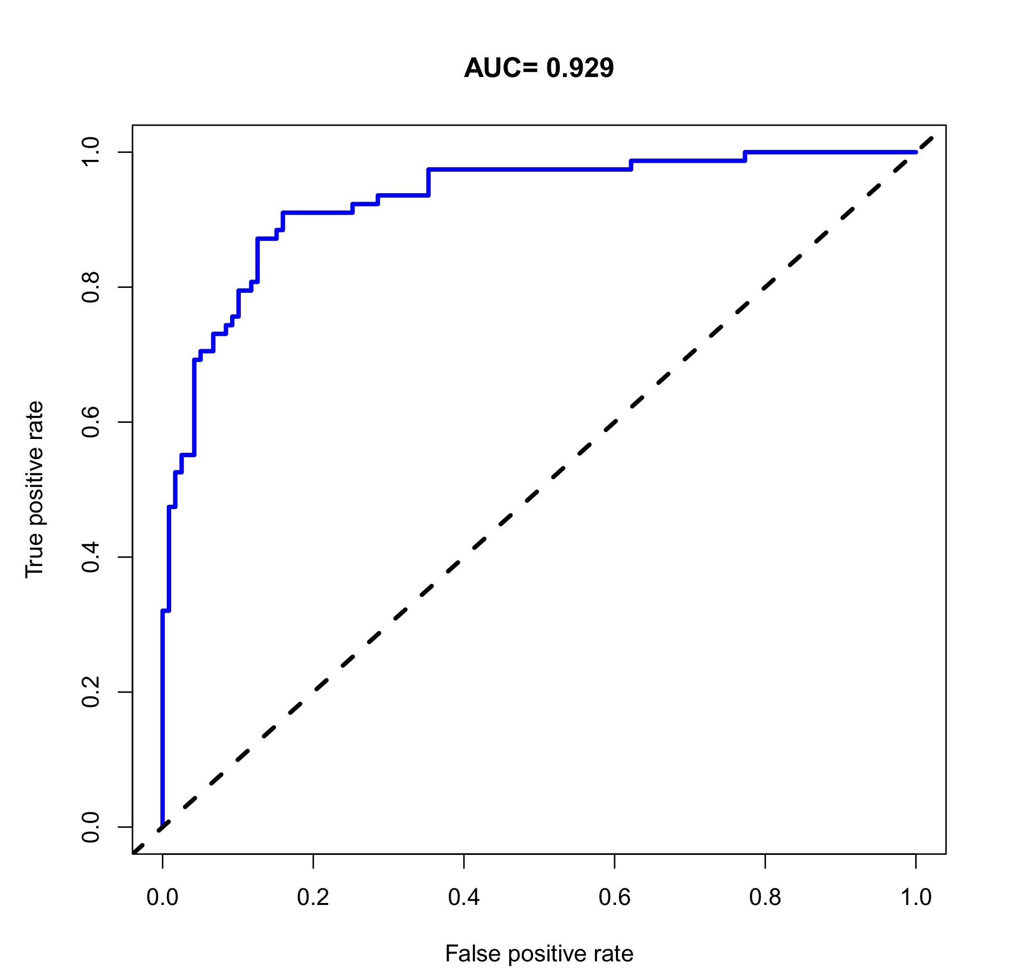 ROC curves depicting the prognostic prediction model for
intravenous thrombolytic therapy in patients with AIS. AUC: area under the
curves.