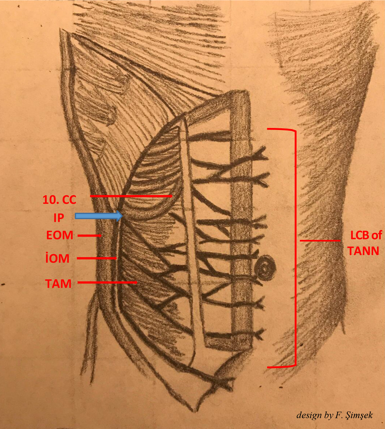 Anterior abdominal wall anatomy and innervation. IP: injection 
point; LCB of TANN: lateral cutaneous branches of thoracoabdominal nerves; CC: 
Costal Cartilage; EOM: External Oblique Muscle; IOM: Internal Oblique Muscle; 
TAM: Transversus Abdominis Muscle.