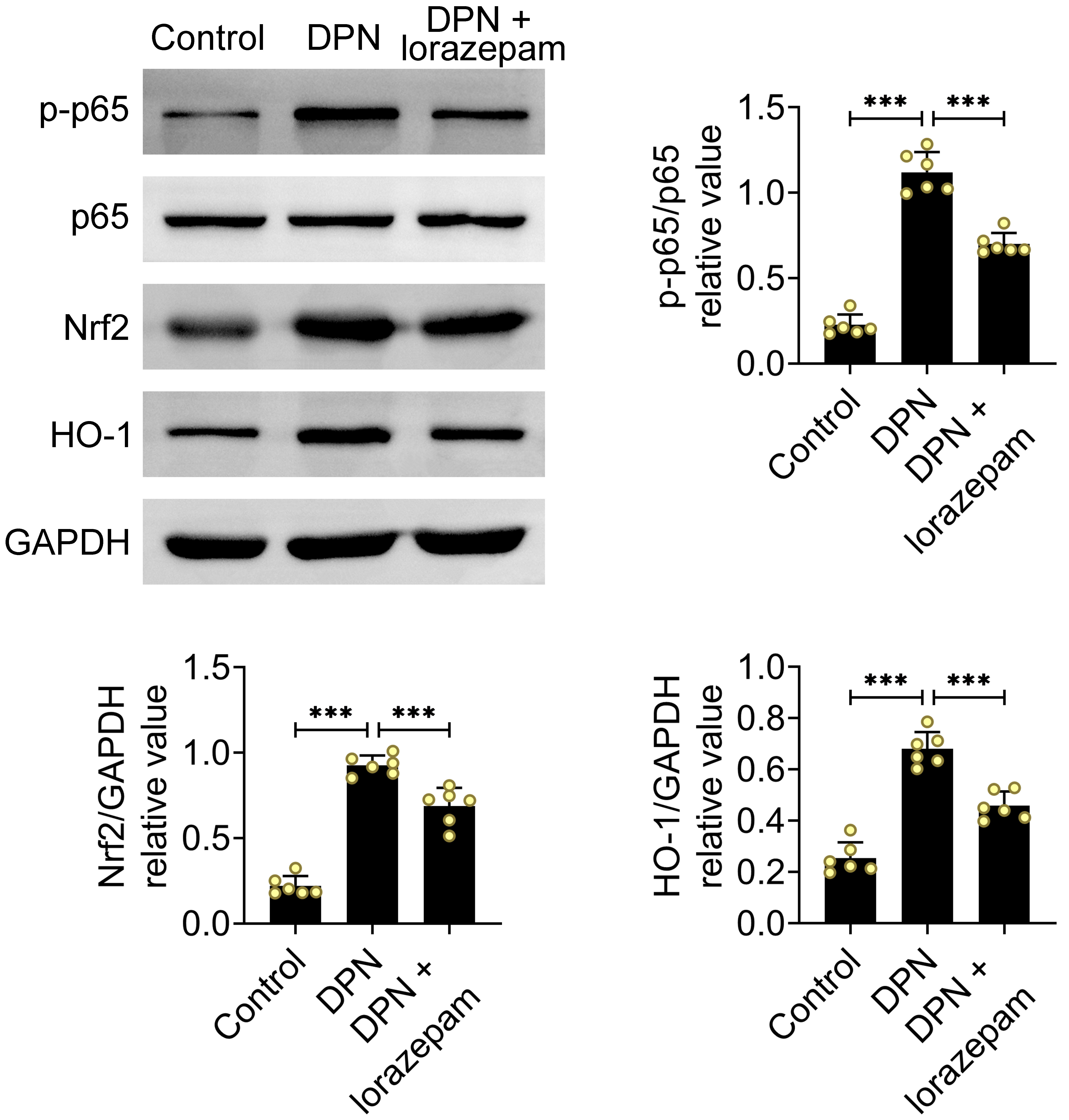 Lorazepam can obstruct the NF-κB and Nrf2 pathways. The investigated rats were categorized into Control (n = 6), DPN (n = 6), and DPN +
lorazepam (n = 6) groups. Protein expressions of p-p65, p65, Nrf2 and HO-1 in
spinal cords were analyzed by western blot. Data are presented as mean ±
SEM. ***p < 0.001. DPN: Diabetic peripheral
neuropathy; p-p65: phosphorylation-p65;
Nrf2: Nuclear factor erythroid 2-related
factor 2; HO-1: Heme Oxygenase-1;
GAPDH: glyceraldehyde-3-phosphate
dehydrogenase.