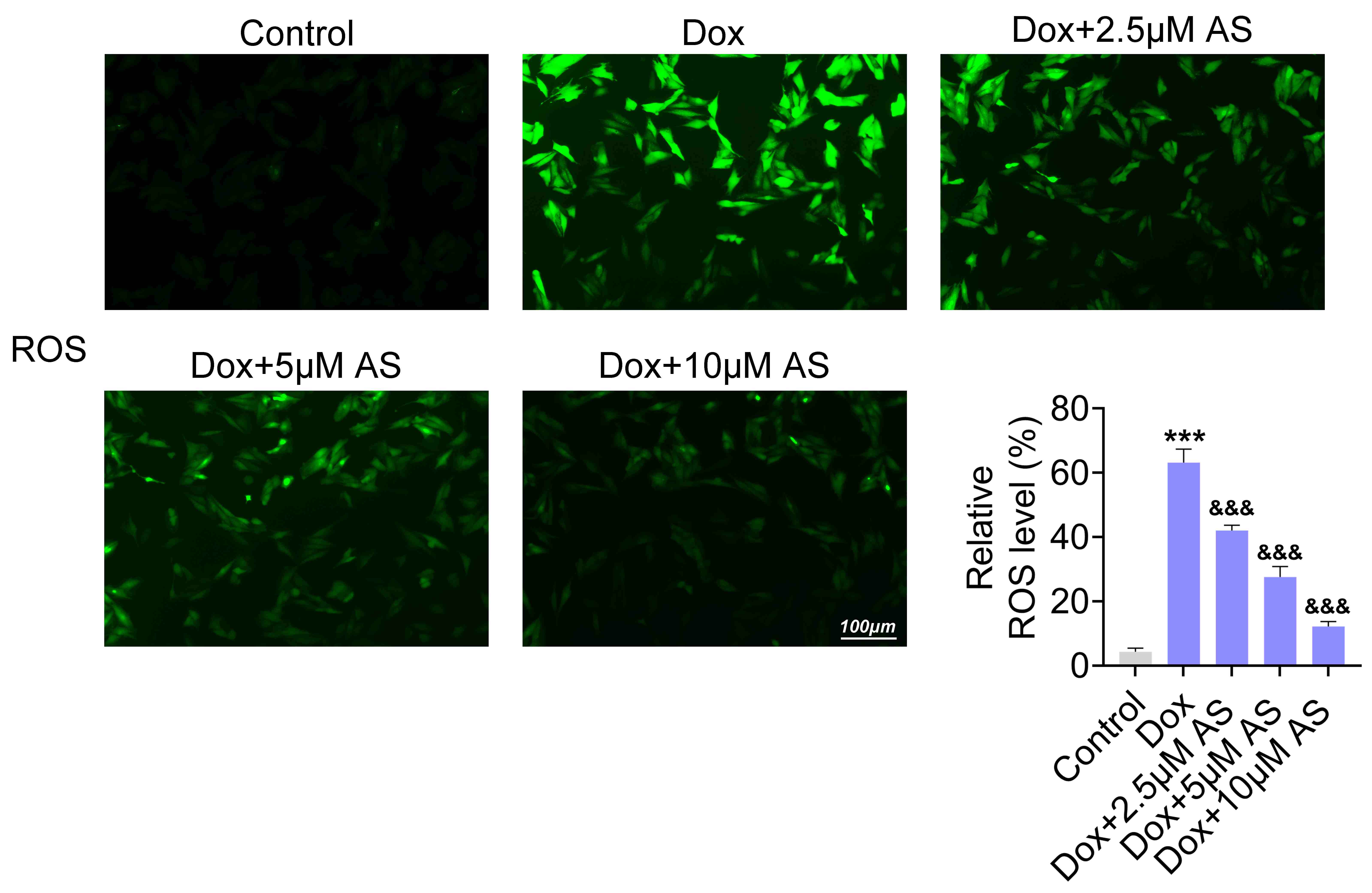 AS reduces ROS production in Dox-stimulated H9C2 cells. DCFH-DA
fluorescence indicating ROS levels in H9C2 cells treated with Dox (1 μM)
alone and in combination with different concentrations of AS (2.5, 5, 10
μM). The green panel represents DCFH-DA fluorescence. Scale bar, 100
μm. ROS: reactive oxygen species; Dox: Doxorubicin hydrochloride; AS:
Artesunate. ***p < 0.001 compared to the control group;
&&&p < 0.001 compared to Dox group.