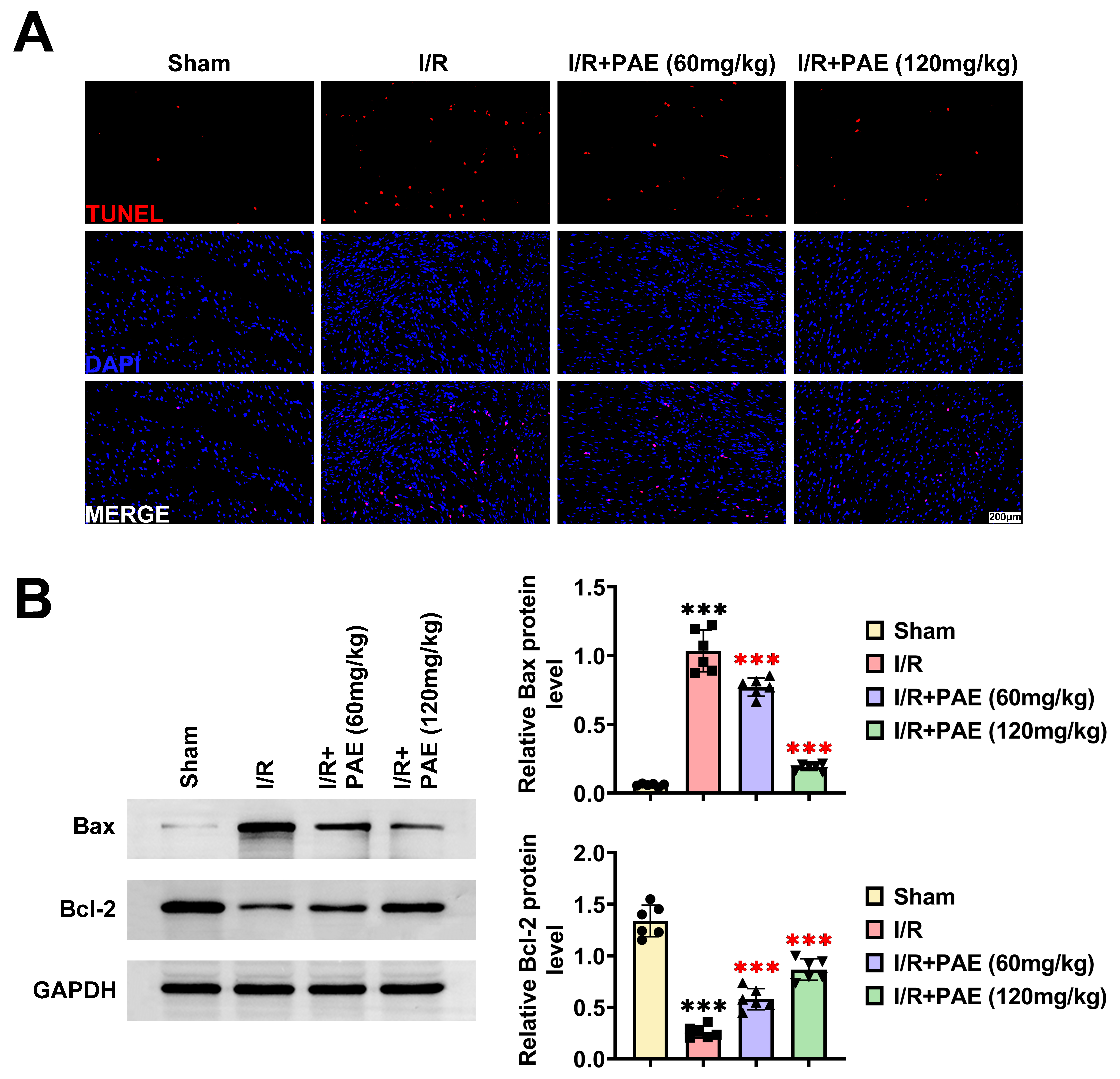 PAE inhibits myocardial cell apoptosis in I/R rats. (A)
Apoptosis of myocardial cells was evaluated by TUNEL staining. (B) The protein
levels of Bax and Bcl-2 in myocardial tissues were analyzed by western blot.
Statistical significance is indicated as follows: ***p < 0.001. The
black asterisks denote comparisons with the sham group, and the red asterisks
denote comparisons with the I/R group. I/R: ischemia-reperfusion; PAE:
perillaldehyde; TUNEL: terminal-deoxynucleoitidyl transferase mediated nick end
labeling; DAPI: diamidinyl phenylindole; MERGE: merger; Bax: BCL2 associated X;
Bcl-2: BCL2 apoptosis regulator; GAPDH: reduced
glyceraldehyde-phosphate dehydrogenase.