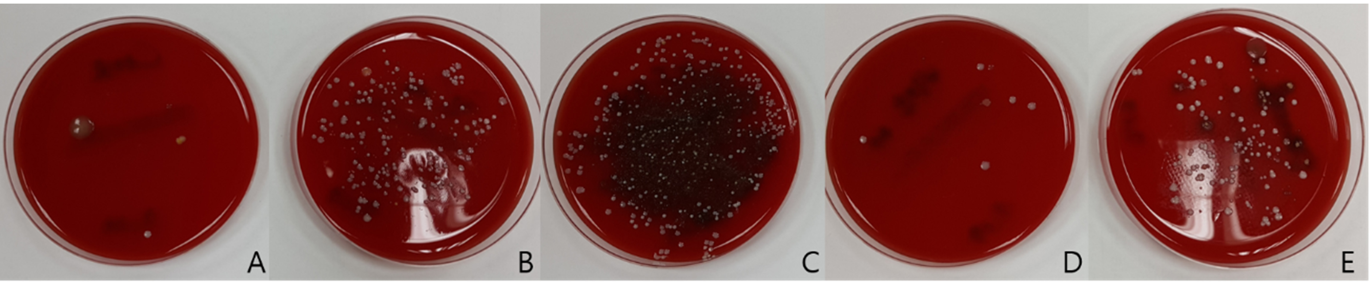 Bacterial culture on mask. (A) control; (B) cotton mask; (C) KF94; (D) anti-droplet mask; (E) dental mask.