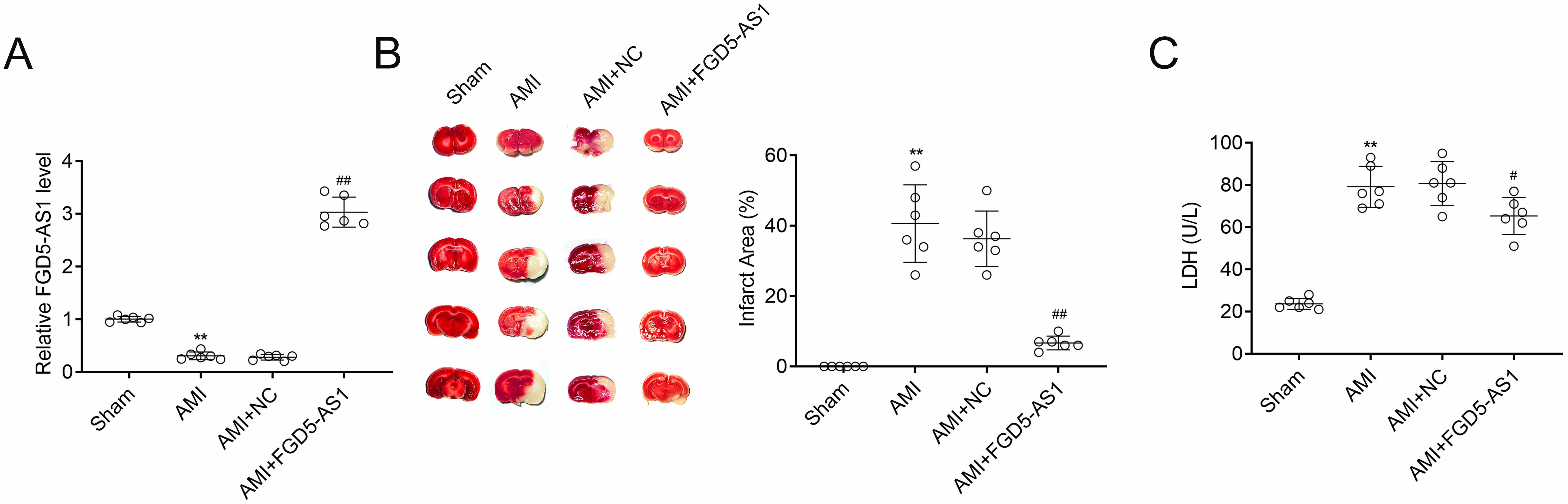 FGD5-AS1 alleviates myocardial damage caused by acute
myocardial infarction. (A) The mRNA expression levels of FGD5-AS1 in
rats in each group. (B) Infarction volume was assessed to check protective effect
of FGD5-AS1 on AMI rats in each group. (C) The protein expression levels
of LDH of rats in each group. Data were presented as the mean ± SD with
three independent experiments. **p < 0.01 versus sham group,
#p < 0.05, and ##p < 0.01 versus AMI + NC
group. AMI: Acute myocardial infarction; LDH: lactate dehydrogenase;
FGD5-AS1: FGD5 Antisense RNA 1; NC: Negative control.