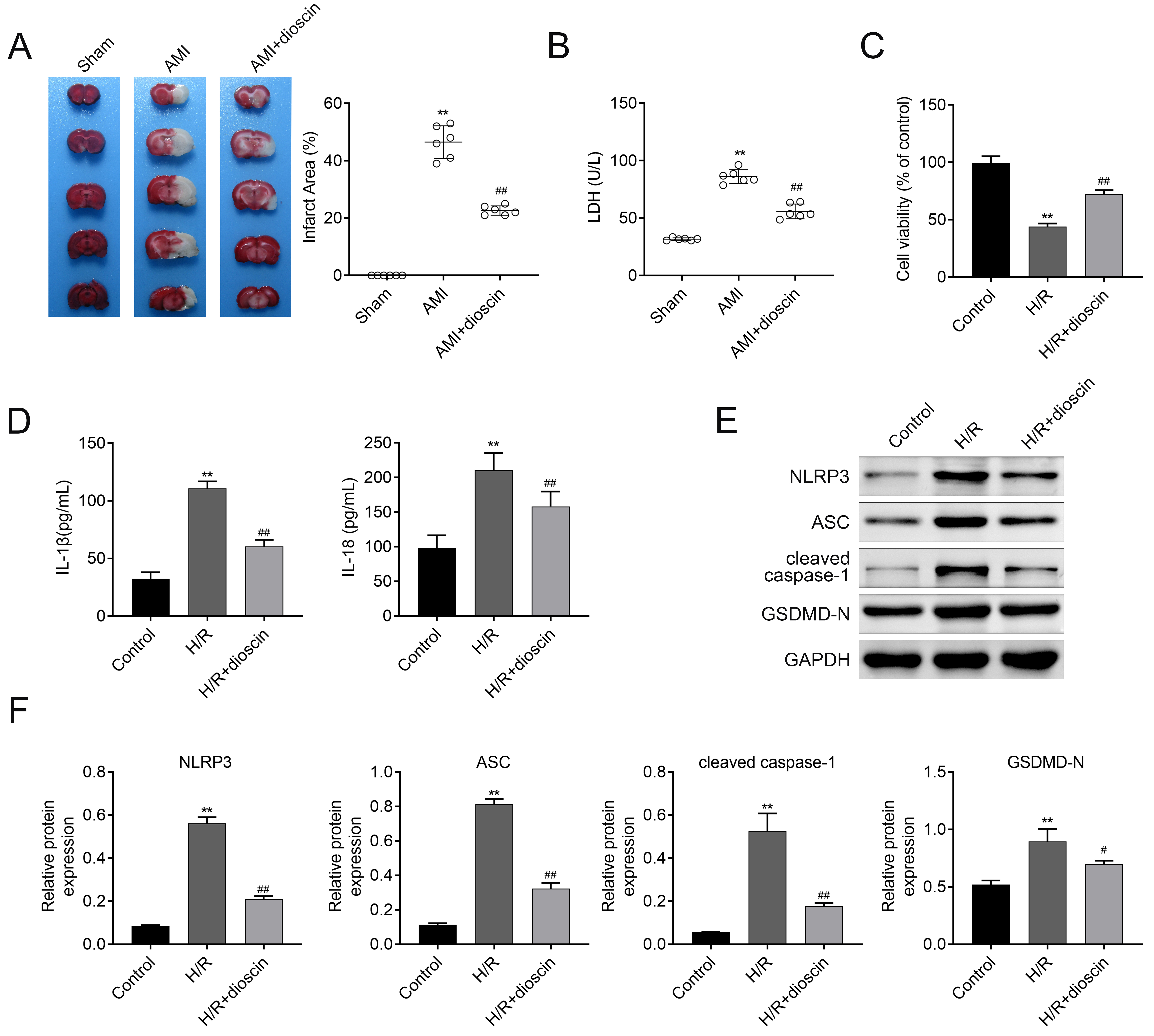 Dioscin alleviates myocardial damage and cardiomyocyte
pyroptosis caused by acute myocardial infarction. (A) Infarction volume was
assessed to check protective effect of dioscin on AMI rats in each group. (B) The
protein expression levels of LDH of rats in each group. (C) Cell proliferation
ability of H9C2 was detected using MTT assay. (D) The protein expression levels
of IL-18 and IL-1β of H9C2 in each group. (E) Western blot was applied to
detect inflammation and cell pyroptosis-related proteins in H9C2 in each group. (F) Statistics of relative protein expression levels of inflammation and cell pyroptosis-related proteins in H9C2 in each group.
Data were presented as the mean ± SD with three independent experiments.
**p < 0.01 versus sham group, #p < 0.05, and
##p < 0.01 versus AMI + dioscin group. AMI: Acute myocardial
infarction; LDH: lactate dehydrogenase; H/R: hypoxia/re-oxygenation; IL:
interleukin; NLRP3: NOD-like receptor thermal protein domain associated protein
3; ASC: apoptosis associated speck like protein containing a CARD; GSDMD-N:
gasdermin; GAPDH: glyceraldehyde-3-phosphate dehydrogenase.