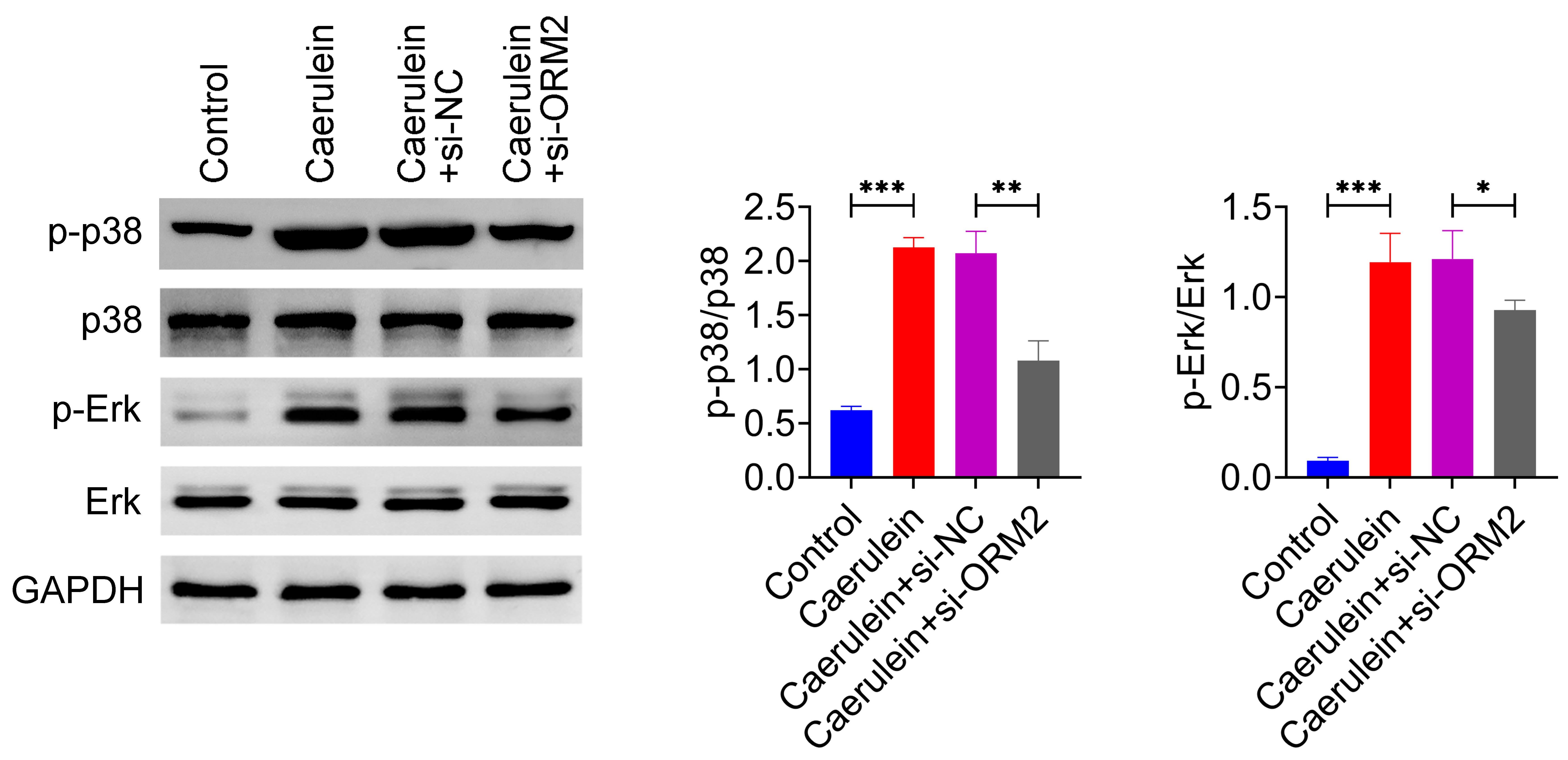 Knockdown of ORM2 inhibits the p38 MAPK signaling pathway. 
Western blotting to detect p38, p-p38, ERK and p-ERK protein expression in AR42J 
cells. Values are presented as mean ± SD. *p < 0.05, 
**p < 0.01, ***p < 0.001. n = 3. ERK: extracellular 
signal-regulated kinase; ORM2: orosomucoid 2; si-NC: si-control; GAPDH: 
glyceraldehyde 3-phosphate dehydrogenase.