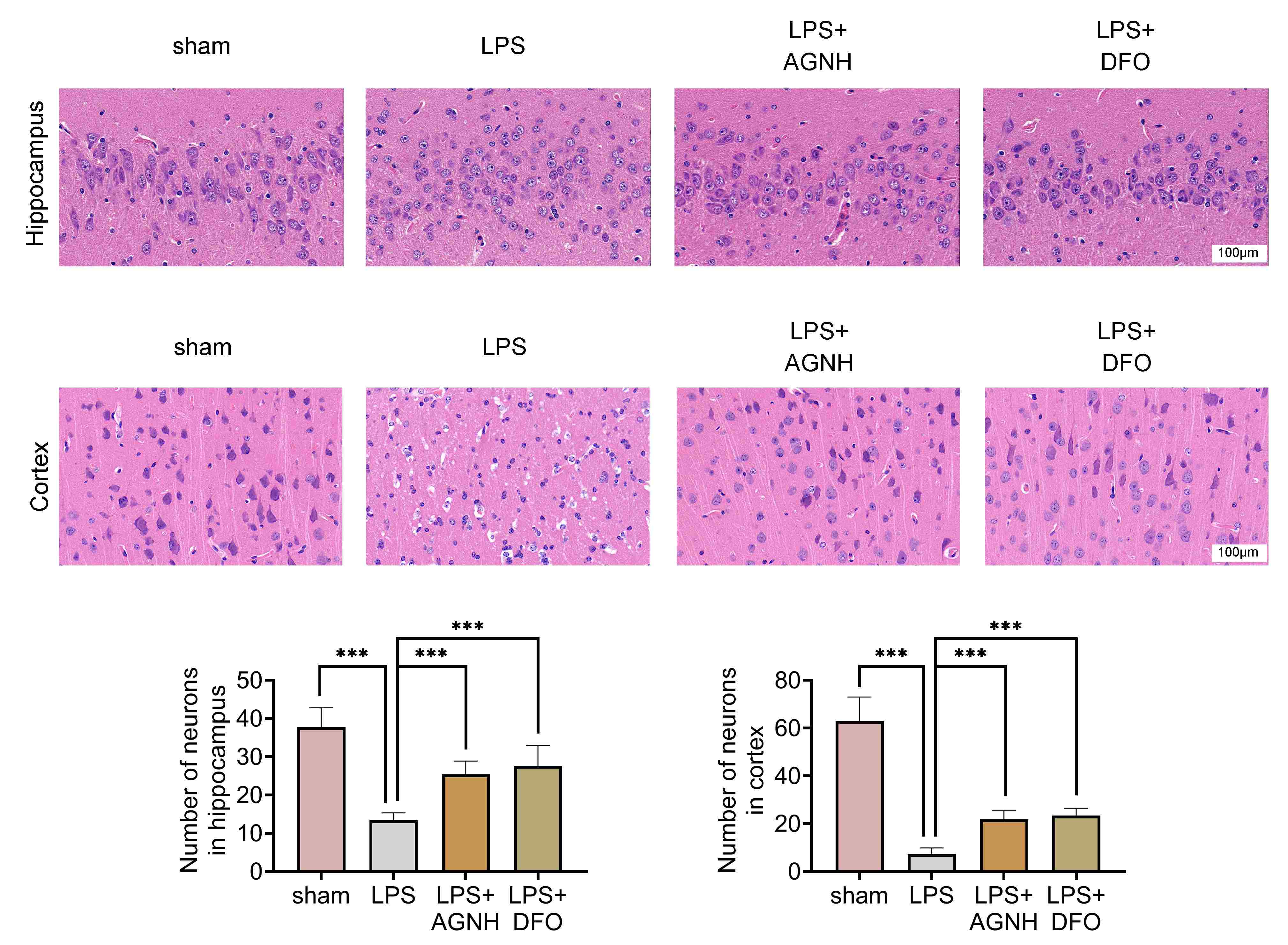 AGNH alleviated neuronal injury in juvenile SAE
mice. Mice were separated into the sham,
LPS, LPS + 100 mg/kg AGNH and LPS + 100 mg/kg DFO groups.
The number and morphology of neurons
(Hippocampus and Cortex) were evaluated through HE staining.
Bar = 100 μm. N = 6 mice in each group.
***p < 0.001. LPS: lipopolysaccharide; AGNH: Angong Niuhuang Pill;
DFO: Defetoxamine.