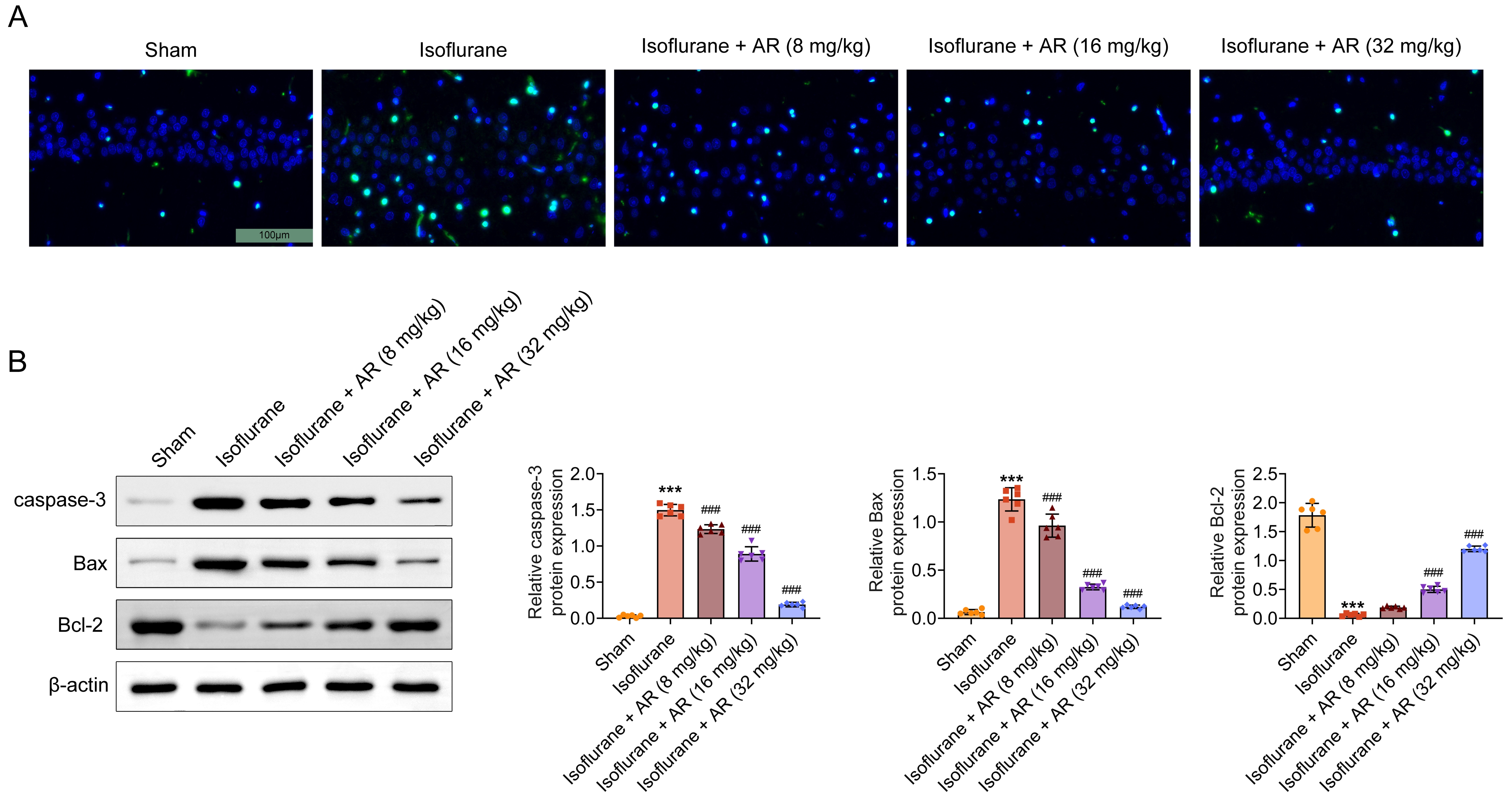 Clematichinenoside AR can inhibit isoflurane-stimulated
apoptosis in mice hippocampus. (A) TUNEL assay was conducted to determine cell
apoptosis for each group. (B) Western blot was conducted to detect cell
apoptosis-related proteins for each group. Relatively quantitative results were
determined by Image J and shown as a histogram. Data were presented as the mean
± SD with three independent experiments. ***p < 0.001
versus sham group, ###p < 0.001 versus isoflurane group. AR:
Clematichinenoside AR; Bcl-2: B-cell lymphoma 2.