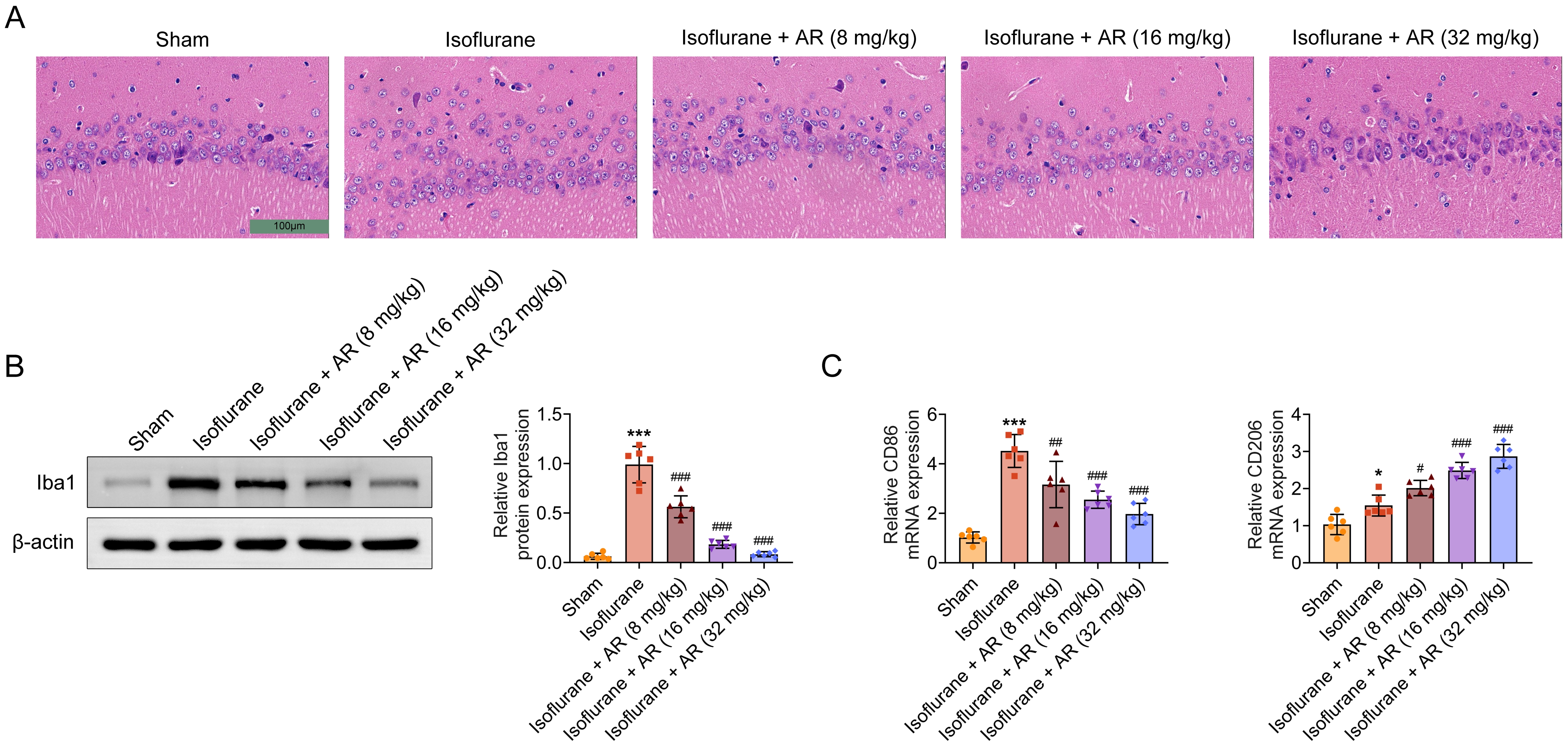 Clematichinenoside AR can inhibit isoflurane-stimulated
activation of microglia cells in mice hippocampus. (A) H&E staining of the
hippocampus of mice in each group. (B) The protein expression levels of Iba1 in
the hippocampus of mice in each group. Relatively quantitative results were
determined by Image J and shown as a histogram. (C) The mRNA expression levels of
CD86 and CD206 in mice in each group. Data were presented as the mean ± SD
with three independent experiments. *p < 0.05, ***p < 0.001 versus sham
group, #p < 0.05, and ##p < 0.01,
###p < 0.001 versus isoflurane group. AR: Clematichinenoside
AR; Iba1: Ionized Calcium Binding Adaptor Molecule 1.