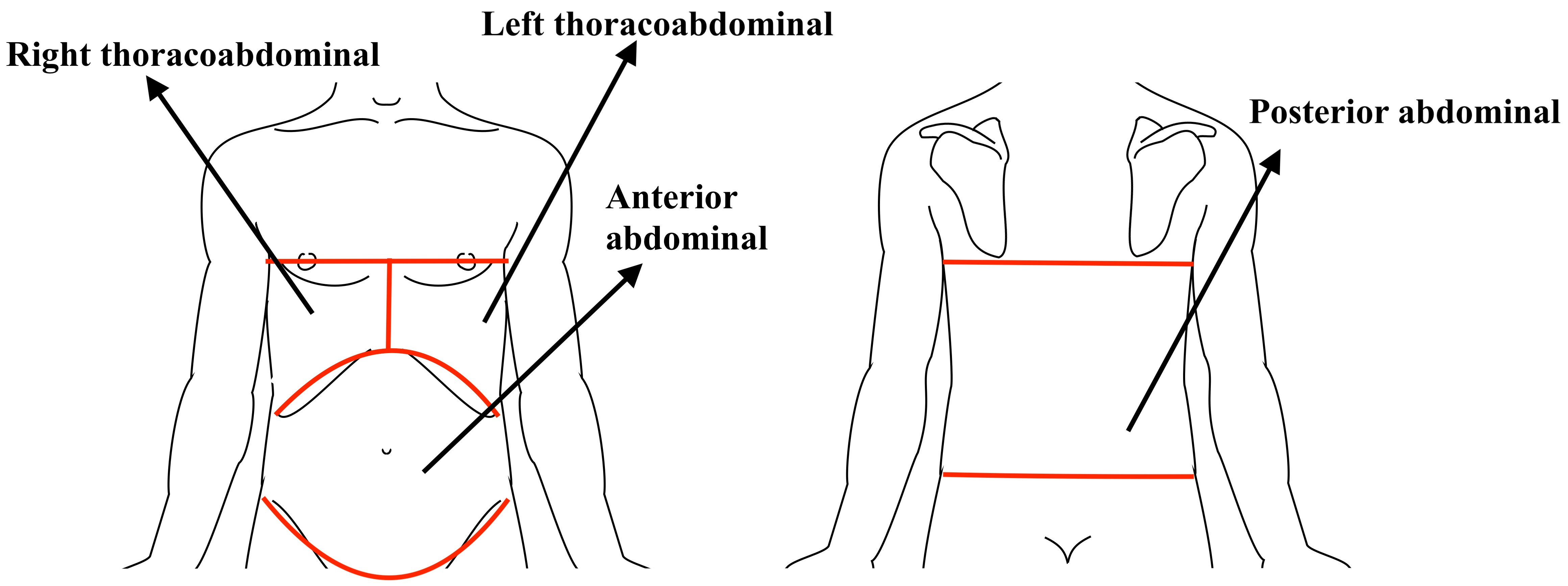 Anatomic regions of injuries.