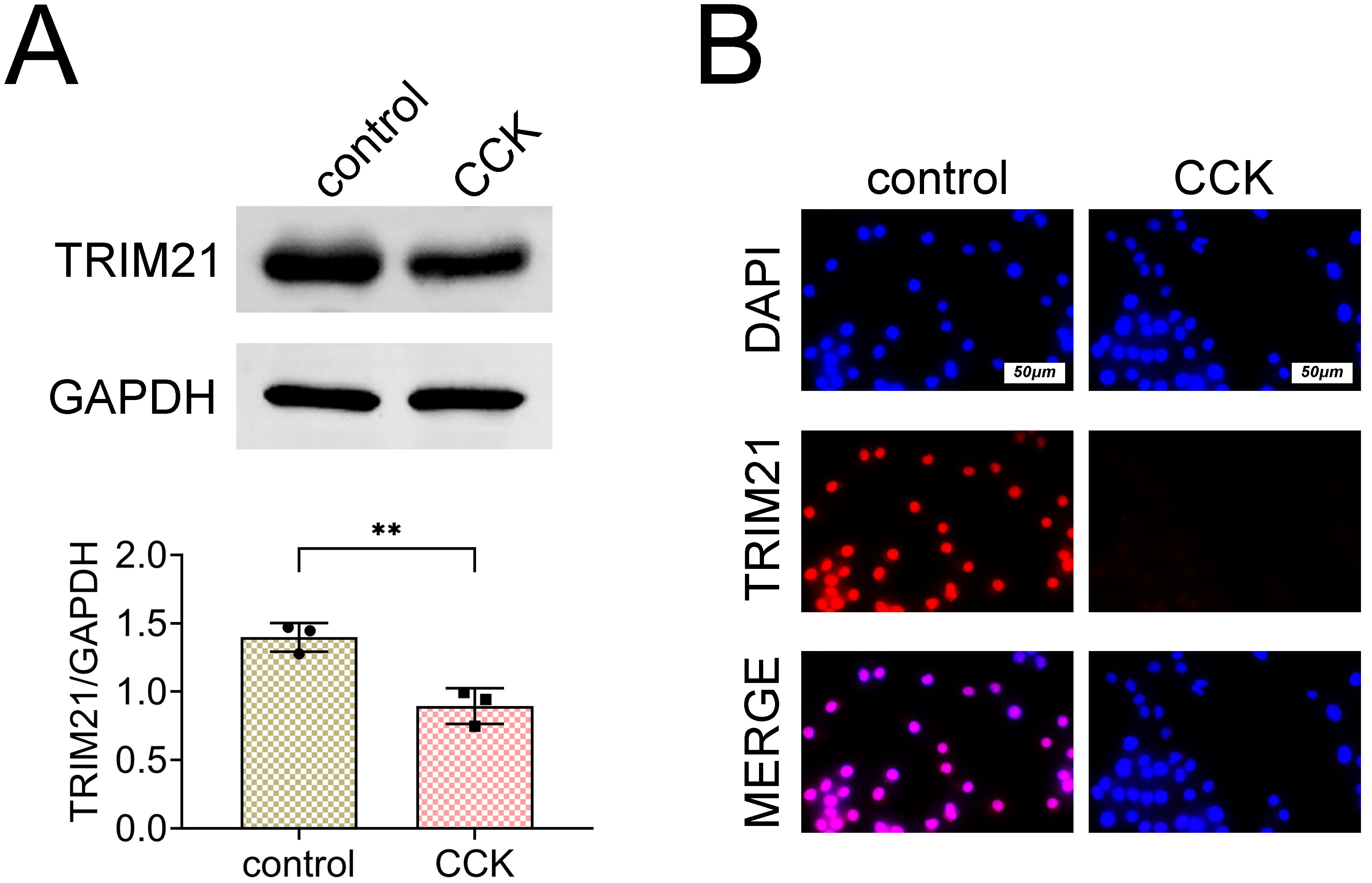TRIM21 protein expression is
downregulated in the AP cell model. (A) Western blot analysis confirmed the
reduced protein expression of TRIM21 in the CCK-treated group compared to the
control group. N = 3. Data are presented as the mean ± SD. p <
0.01. (B) Immunofluorescence (IF) assay further verified the downregulation of
TRIM21 protein expression following CCK treatment. TRIM21: tripartite
motif-containing protein 21; CCK: cholecystokinin; GAPDH:
glyceraldehyde-3-phosphate dehydrogenase; MERGE: merge;
DAPI: 4′,6-Diamidino-2-phenylindole.
**p < 0.01.
