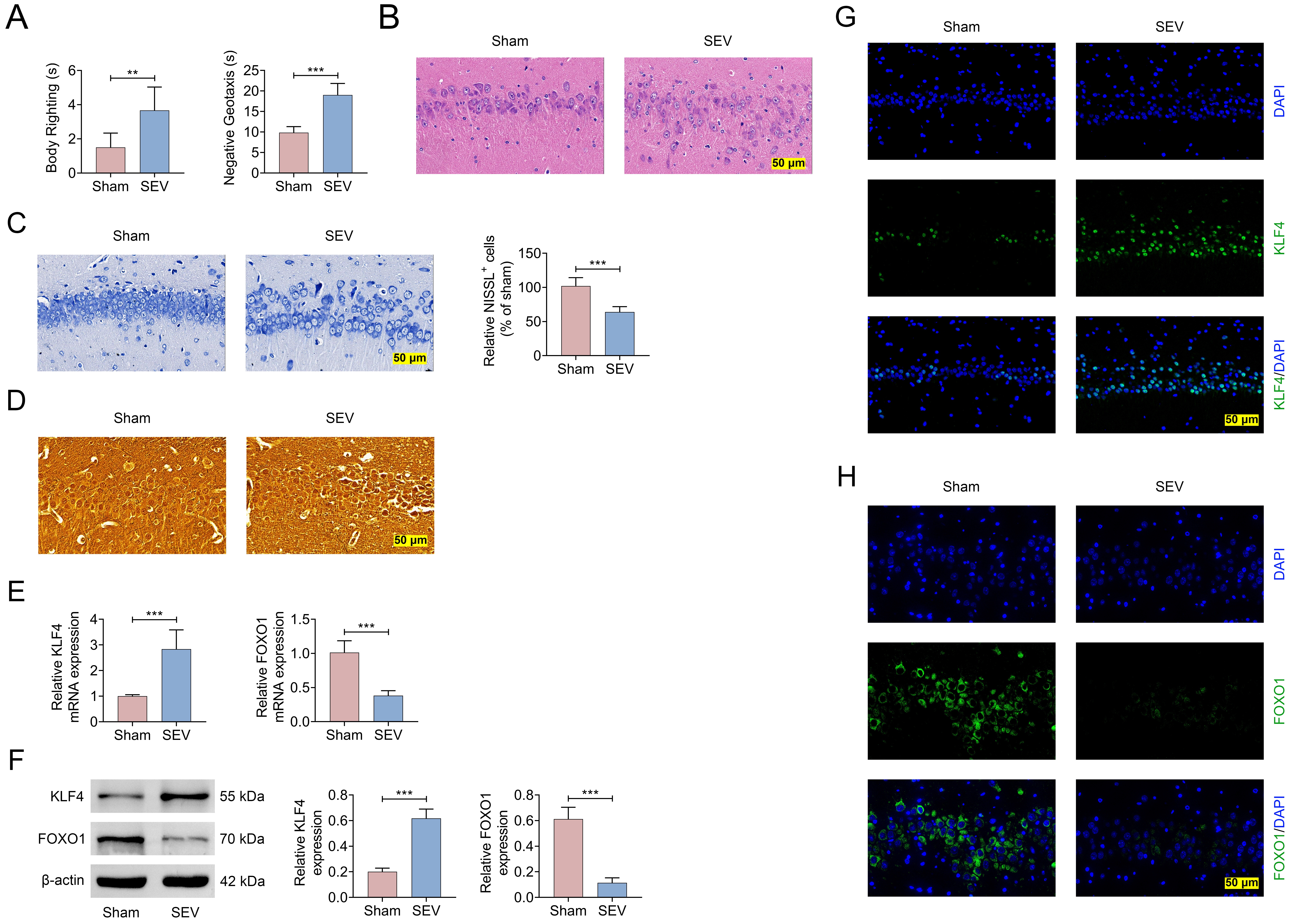 KLF4 expression was elevated and FOXO1 expression was decreased
in the hippocampus of neonatal rats treated with 3% SEV. Recombinant AAVs were
injected intravenously into neonatal rats before SEV exposure with or without 3%
SEV treatment. Neonatal rats were divided into two groups: Sham group and SEV
group. (A) Body righting and negative geotaxis; (B) Histopathological changes of
hippocampus were determined by H&E staining; (C) Nerve injury in hippocampus was
measured using NISSL staining; (D) NISSL+ cells; (E) Modified Bielschowsky
ammonia silver staining was used to evaluated nerve fiber damage in the
hippocampus; (F) The mRNA levels of KLF4 and FOXO1 were measured by RT-qPCR;
(G,H) The expression of KLF4 and FOXO1 were measured by western blotting and
immunohistochemistry. (**p < 0.01, ***p
< 0.001, Sham group vs. SEV group). SEV: sevoflurane; KLF4:
Krüppel-like factor 4; FOXO1: Forkhead box transcription factor O1;
NISSL+: NISSL-positive; DAPI: 4′,6-Diamidino-2-Phenylindole.