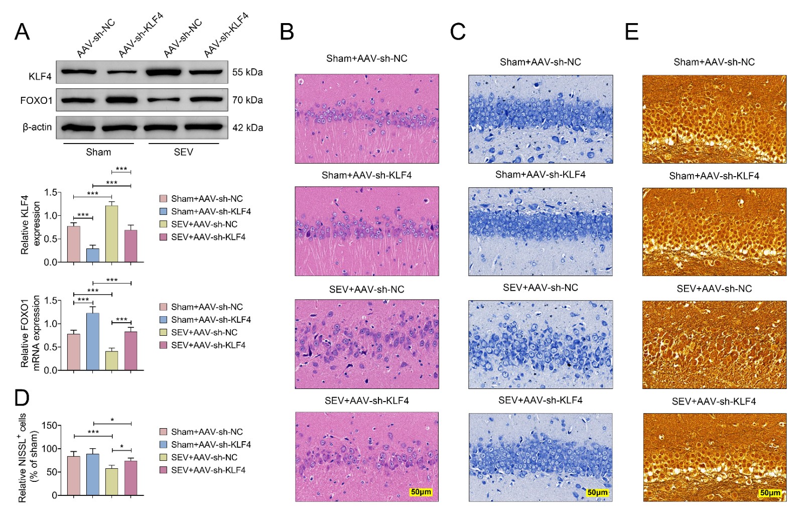 KLF4 knockdown reversed SEV-induced nerve injury in neonatal
rats. Neonatal rats were divided into four groups: (1) Sham + AAV-sh-NC; (2)
Sham + AAV-sh-KLF4; (3) SEV + AAV-sh-NC; (4) SEV + AAV-sh-KLF4. (A) The
expression of KLF4 and FOXO1 were measured by western blotting; (B)
Histopathological changes of hippocampus were determined by H&E staining; (C)
Nerve injury in hippocampus was measured by NISSL staining; (D) NISSL+ cells; (E)
Modified Bielschowsky ammonia silver staining was used to evaluated nerve fiber
damage in the hippocampus. (*p < 0.05, ***p
< 0.001, Sham + AAV-sh-NC vs. Sham + AAV-sh-NC or SEV + AAV-sh-NC, or
SEV+AAV-sh-KLF4 vs. SEV + AAV-sh-NC or Sham + AAV-sh-KLF4). AAV:
adeno-associated virus; KLF4: Krüppel-like factor 4; FOXO1: Forkhead box
transcription factor O1; NISSL+: NISSL-positive; SEV: sevoflurane; NC:
negative control; sh-: Short Hairpin RNA.