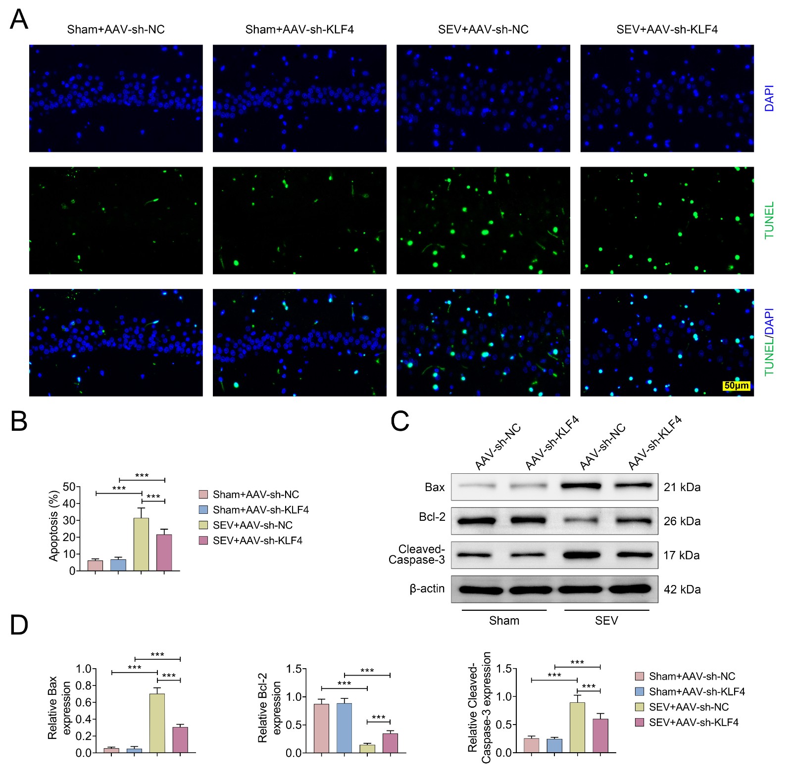 KLF4 knockdown reversed SEV exposure-induced apoptosis in
neuronal cells. Neonatal rats were divided into four groups: (1) Sham +
AAV-sh-NC; (2) Sham + AAV-sh-KLF4; (3) SEV + AAV-sh-NC; (4) SEV + AAV-sh-KLF4.
(A) Apoptosis was measured by TUNEL staining; (B) Measurement of apoptosis rate;
(C) The expression of Bax, Bcl-2 and Cleaved-caspase 3 measured by western
blotting; (D) The expressions of Bax, Bcl-2 and Cleaved-caspase 3 proteins in the
four groups analyzed. (***p < 0.001, Sham + AAV-sh-NC
vs. SEV + AAV-sh-NC, or SEV + AAV-sh-KLF4 vs. SEV + AAV-sh-NC
or Sham + AAV-sh-KLF4). AAV: adeno-associated virus; NC: negative control; KLF4:
Krüppel-like factor 4; SEV: sevoflurane; TUNEL: triphosphate-biotin nick end
labeling; DAPI: 4′,6-Diamidino-2-Phenylindole; sh-: Short Hairpin RNA.