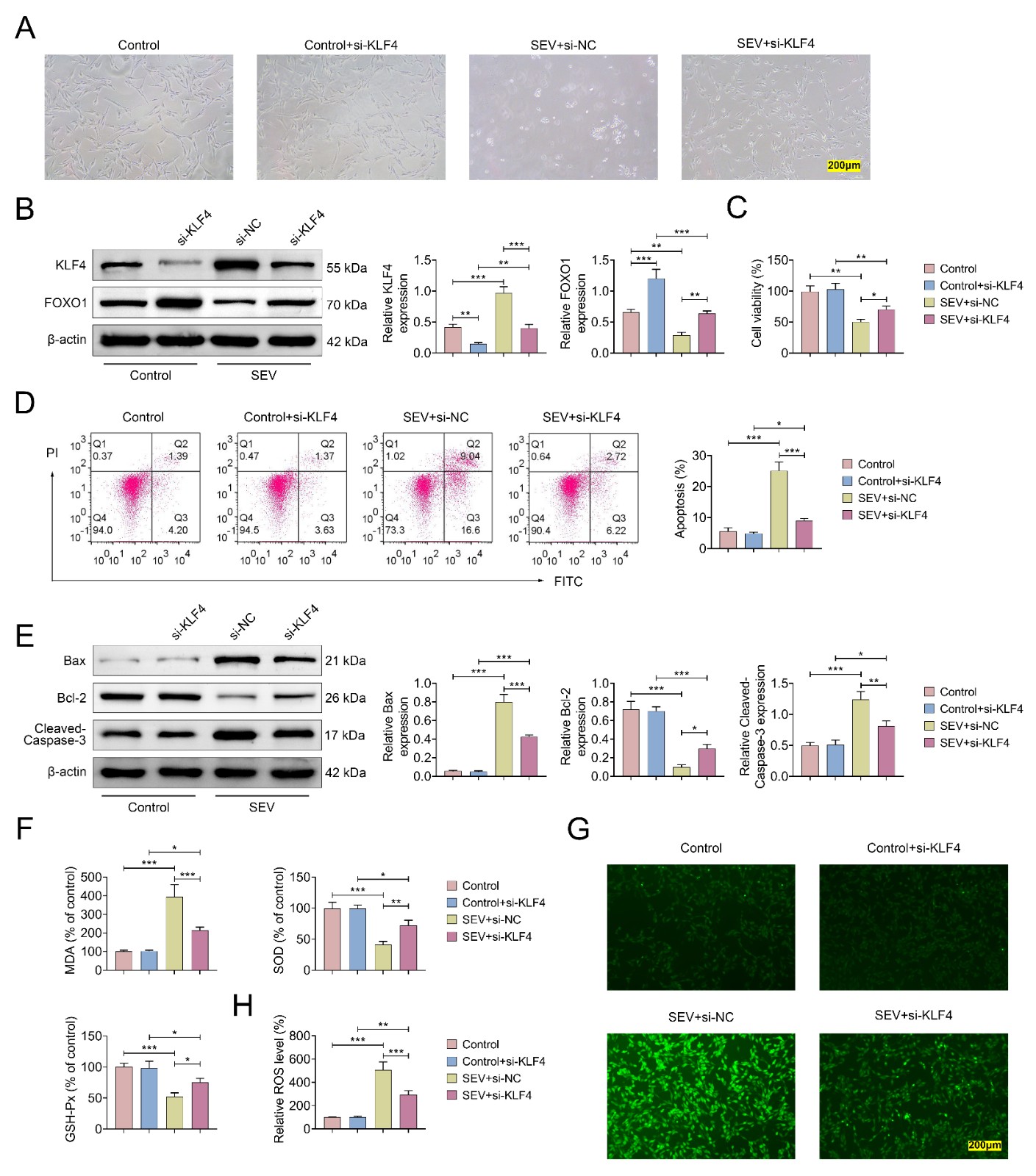 KLF4 knockdown reversed SEV exposure-induced HT22 cell injury.
HT22 cells were divided into four groups: (1) control; (2) control + si-KLF4; (3)
SEV + si-NC; (4) SEV + si-KLF4. (A) Representative cell morphology under light
microscopy; (B) Protein expression of KLF4 and FOXO1 analyzed by Western blot;
(C) Cell viability assessed using the CCK-8 assay; (D) Apoptosis rate determined
by flow cytometry; (E) Expression of apoptosis-related proteins Bax, Bcl-2 and
cleaved caspase-3 detected by Western blot; (F) Quantification of MDA, SOD and
GSH-Px levels; (G) ROS levels assessed by DCF fluorescence staining; (H) ROS
levels measured using commercial assay kits. (*p < 0.05,
**p < 0.01, ***p < 0.001, control
vs. control + si-KLF4 or SEV + si-NC, or SEV + si-KLF4 vs. SEV
+ si-NC or control + si-KLF4). MDA: malondialdehyde; SOD: superoxide dismutase;
GSH-Px: glutathione peroxidase; ROS: reactive oxygen species; NC: negative
control; KLF4: Krüppel-like factor 4; SEV: sevoflurane; FOXO1: Forkhead box
transcription factor O1; PI: propidium iodide; FITC: Fluorescein Isothiocyanate;
si-: Small Interfering RNA.