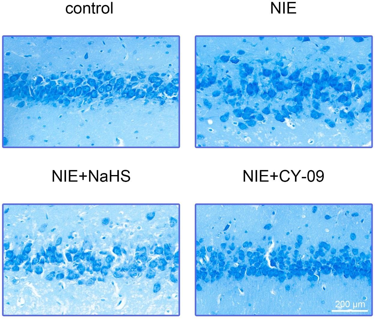 NaHS reduces the neuronal damage in NIE rats. Nissl staining to 
assess each group’s hippocampus neuron damage. NIE: Neonatal hypoxic-ischemic 
encephalopathy; NaHS: Sodium hydrosulfide.