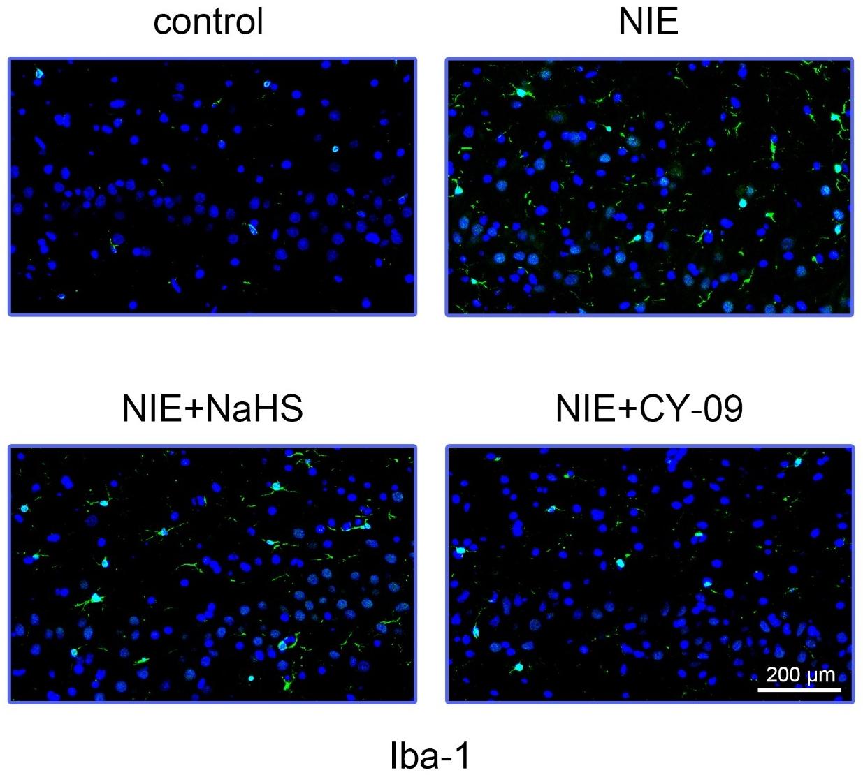 NaHS and CY-09 suppress microglial activation in NIE rats. Iba-1 expression in rat hippocampus tissue was detected by immunofluorescence in 
each group. NIE: Neonatal hypoxic-ischemic encephalopathy; NaHS: Sodium 
hydrosulfide.
