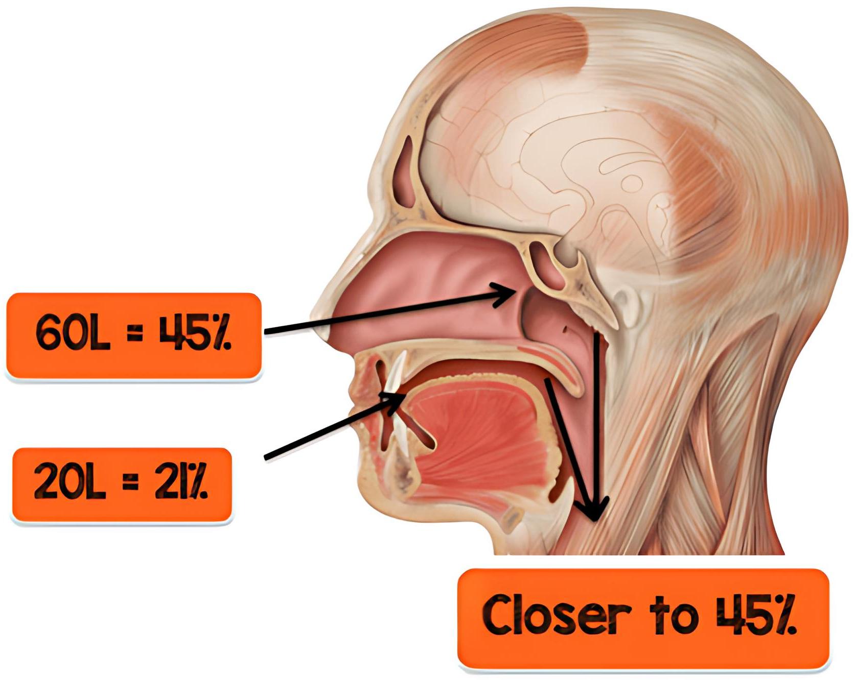 Oxygen dilution with HFNC. FiO₂ (%): Fraction of inspired 
oxygen; L: Liter. Reprinted from “High-flow Nasal Cannula: Mechanisms of Action 
and Adult and Pediatric Indications” by FJ Lodeserto, 2018, Cureus, adapted with 
permission.
