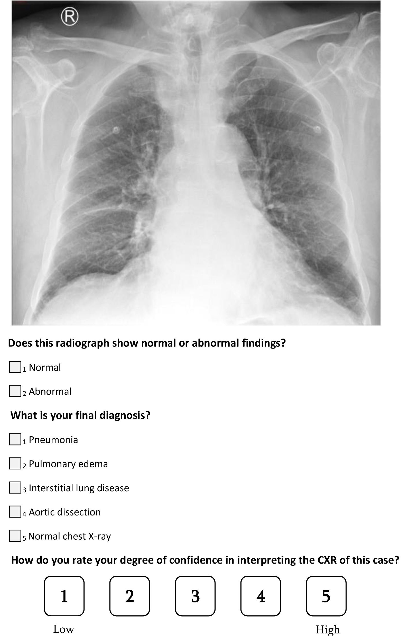 A question from the survey on pulmonary edema. CXR: chest
X-ray.