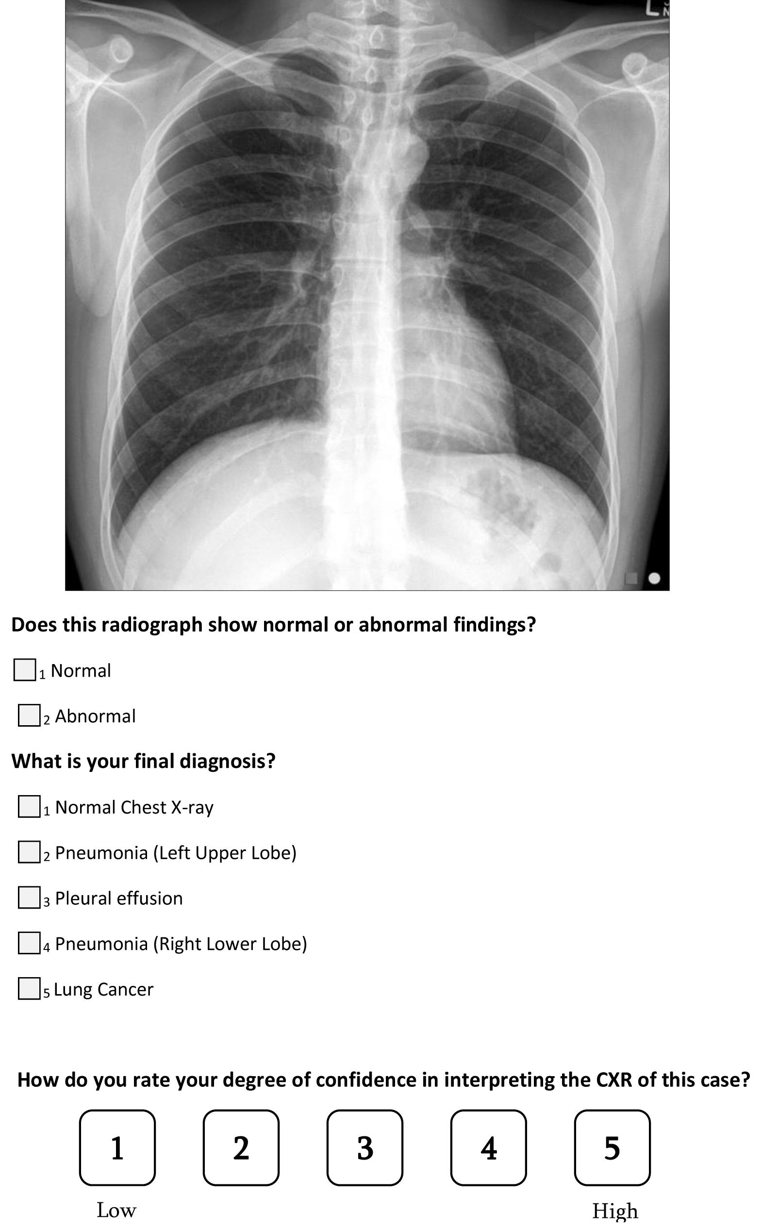 A question from the survey on normal chest X-ray. CXR: chest
X-ray.