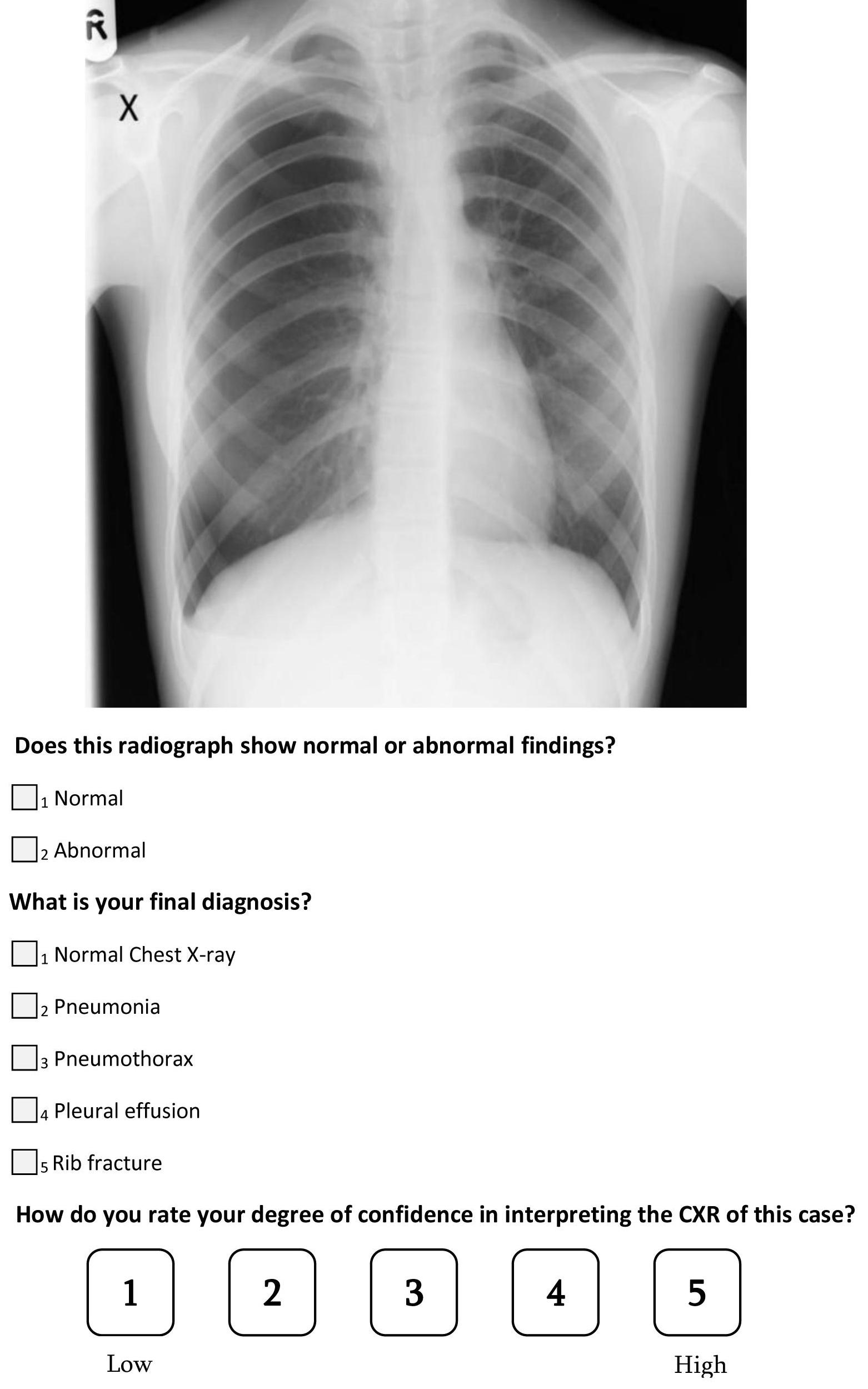 A question from the survey on pneumothorax. CXR: chest X-ray.