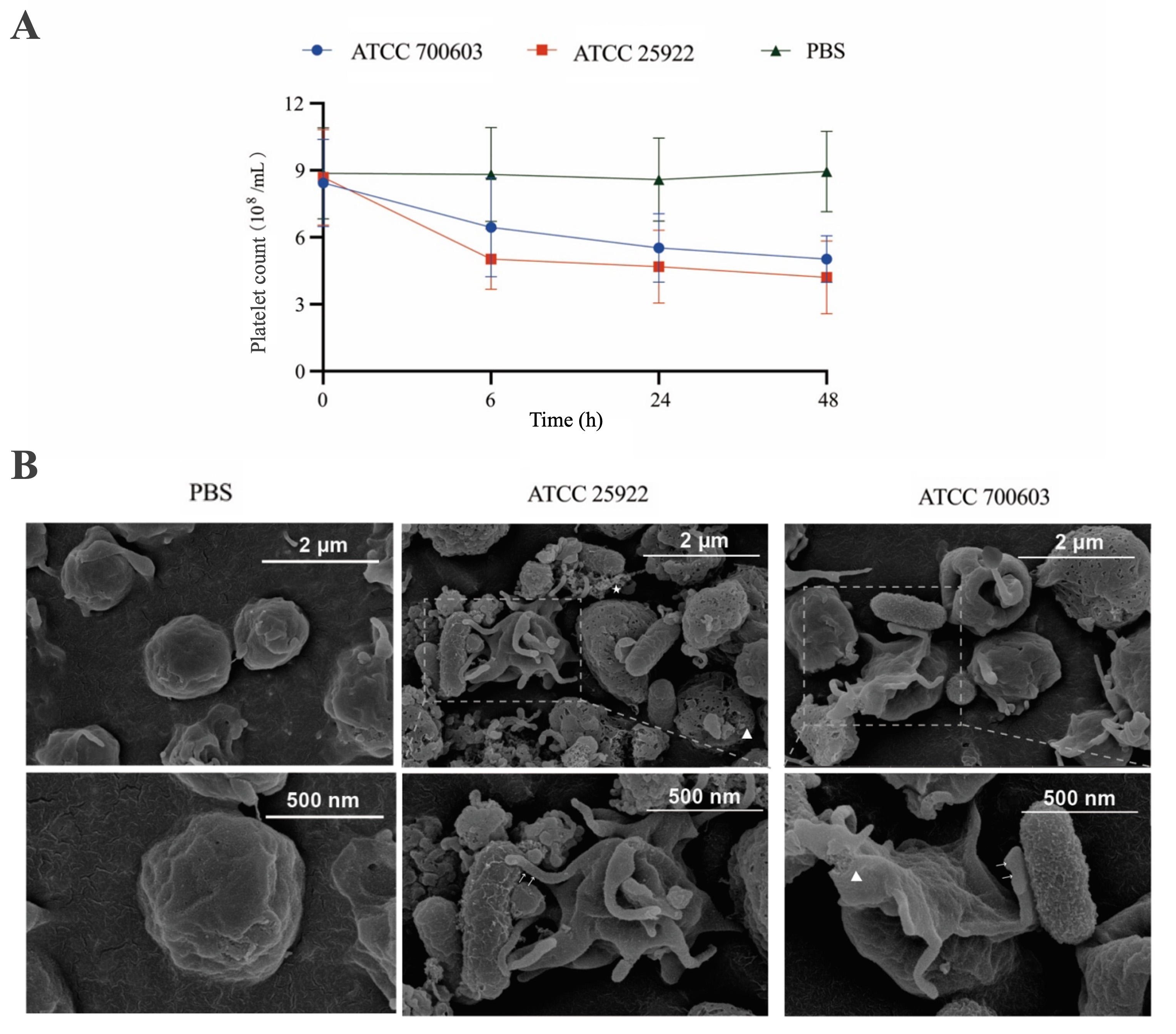 Platelet dynamics and morphological changes in murine bacteremia models.
(A) Platelet count dynamics in bacteremic mice over time. (B) Platelet
morphological changes in K. pneumoniae ATCC 25922 and E. coli
ATCC 700603 bacteremic mice by SEM. Scale bars: low mag 2 µm, high mag 500
nm; arrows indicate platelet pseudopods. ATCC: American Type Culture Collection;
PBS: phosphate-buffered saline.
