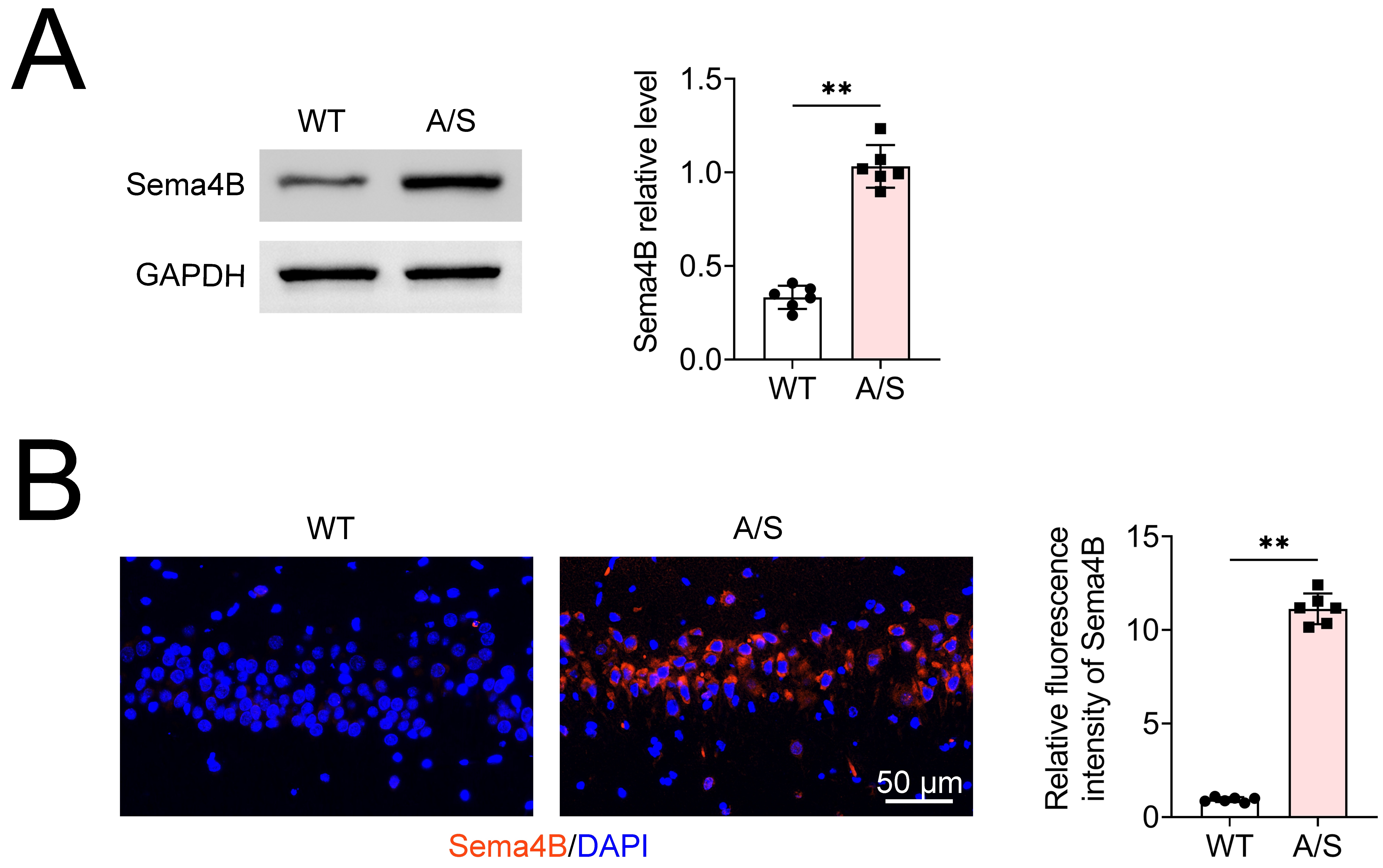 Sema4B is upregulated in the aged mouse PND model. (A) Western
blotting showing Sema4B protein expression in mice hippocampus tissues. (B)
Immunofluorescence detection of Sema4B fluorescence expression in hippocampal
tissue. Values are presented as mean ± SD. **: p < 0.01. n = 6.
Sema4B: Semaphorin 4B; WT: wild-type; A/S: anesthesia/surgery; DAPI:
4′,6-Diamidino-2-phenylindole; GAPDH: Glyceraldehyde-3-Phosphate Dehydrogenase.