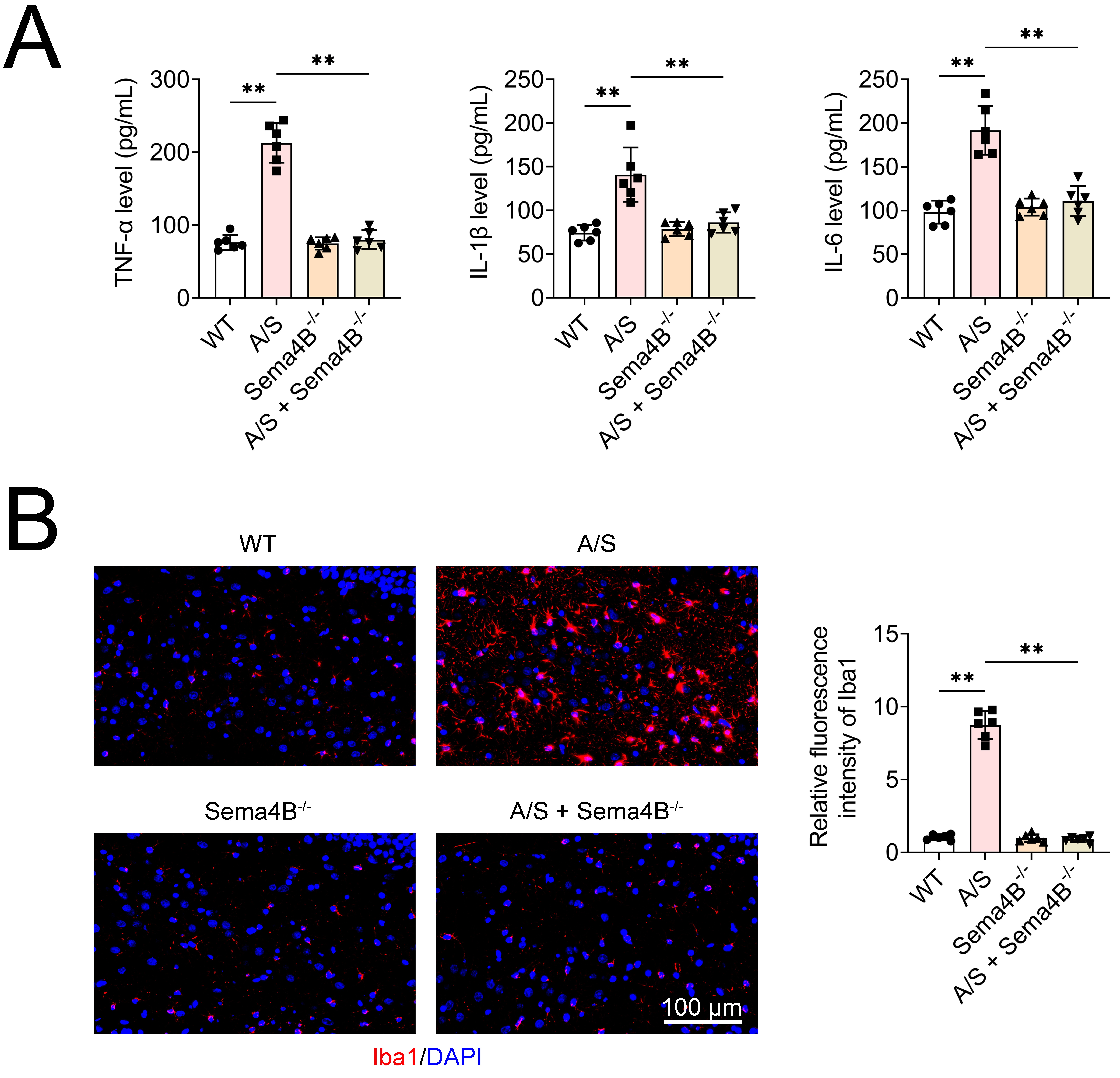 Knockout of Sema4B inhibits hippocampal microglial activation
and neuroinflammation in aged PND mice. (A) ELISA was performed to measure the
levels of inflammatory factors TNF-α, IL-1β, and IL-6 in
hippocampal tissue. (B) Immunofluorescence detection of Iba1 fluorescence
expression in hippocampal tissue. Values are presented as mean ± SD. **:
p < 0.01. n = 6. TNF-α: tumor necrosis factor-α; IL:
interleukin; Sema4B: Semaphorin 4B; WT: wild-type; A/S: anesthesia/surgery;
Sema4B−/−: Sema4B knockout; Iba1: Ionized calcium-binding adapter molecule
1; DAPI: 4′,6-Diamidino-2-phenylindole.