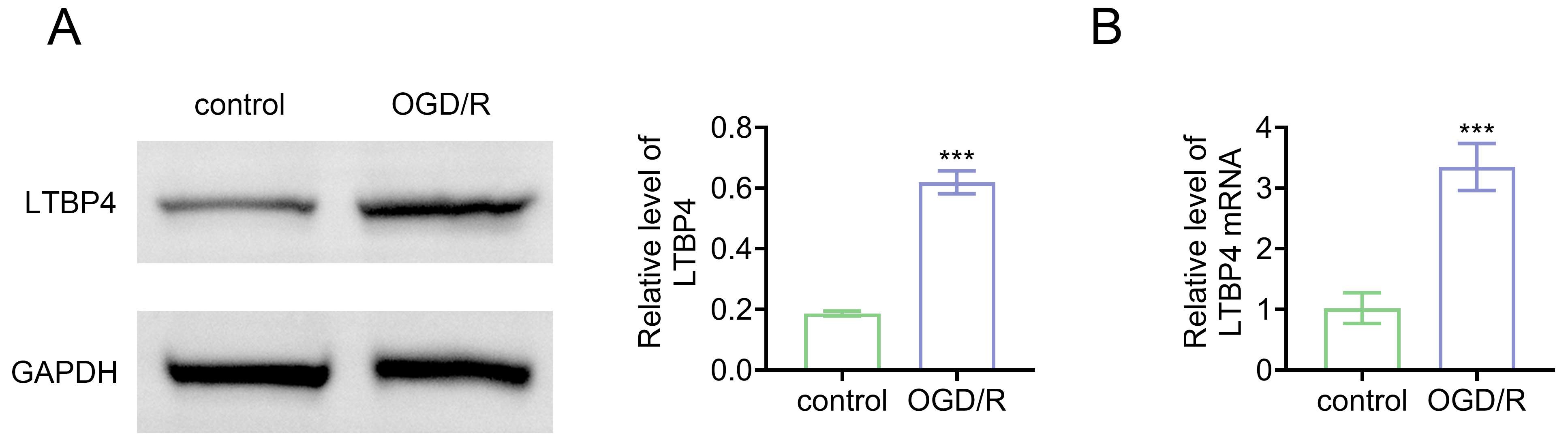 LTBP4 expression is elevated in cardiomyocytes
subjected to OGD/R. (A) Western blot analysis of LTBP4 protein expression in
control and OGD/R-treated groups. (B) Quantification of LTBP4 mRNA
expression by RT-qPCR in control and OGD/R-treated groups. ***p
< 0.001. LTBP4: Latent transforming growth factor-beta binding protein 4;
OGD/R: oxygen-glucose deprivation/reperfusion; GAPDH: glyceraldehyde-3-phosphate
dehydrogenase.