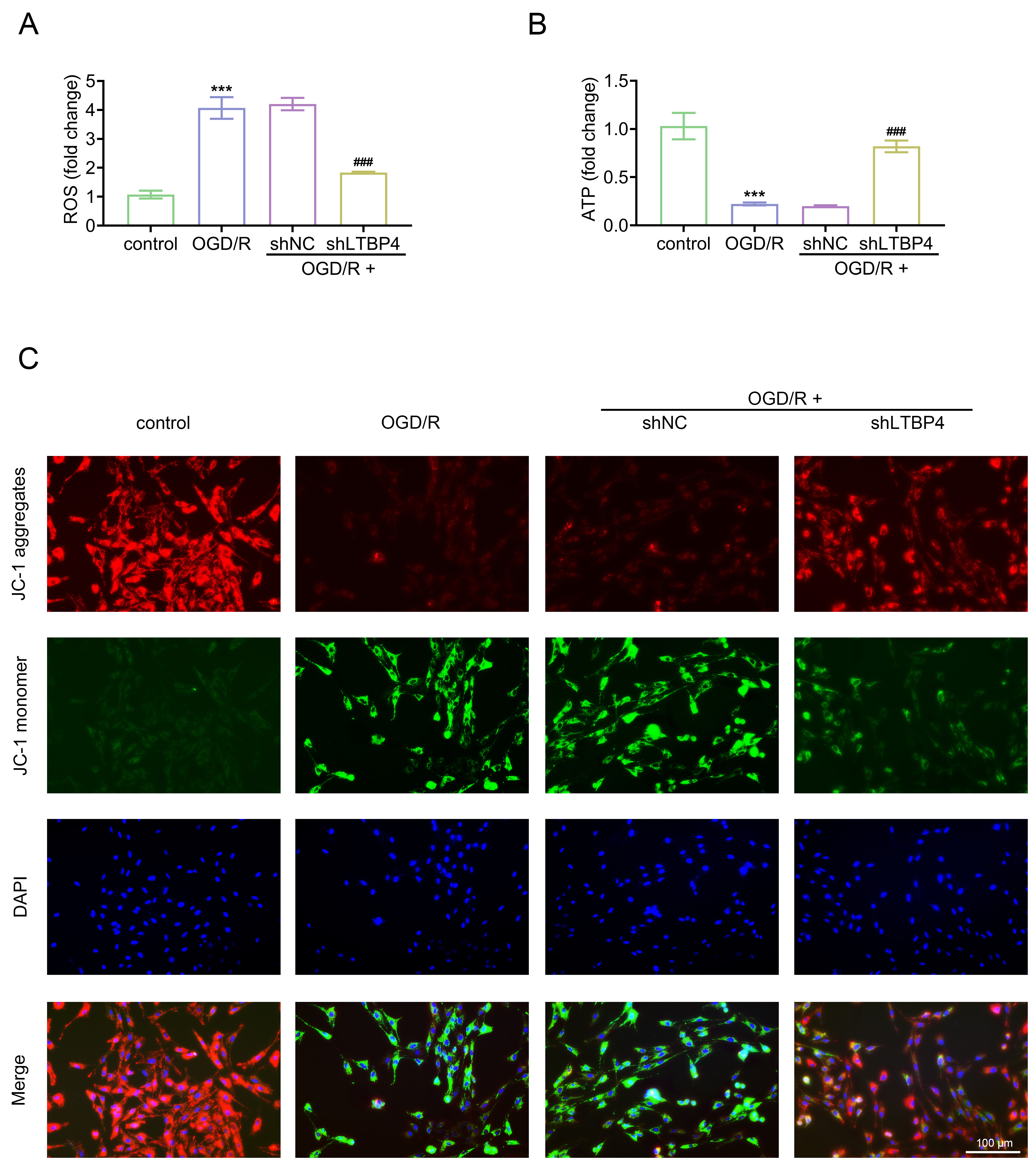 LTBP4 suppression alleviates OGD/R-induced
mitochondrial dysfunction in cardiomyocytes. The cells were divided into
control, OGD/R, OGD/R + shNC, and OGD/R + shLTBP4 groups. (A) Intracellular ROS
levels detected using a ROS assay kit. (B) ATP levels measured using an ATP
detection kit. (C) Mitochondrial membrane potential (MMP) assessed by JC-1
staining. ***p < 0.001 vs. control;
###p < 0.001 vs. OGD/R + shNC. OGD/R: oxygen-glucose
deprivation/reperfusion; shNC: Short hairpin negative control; LTBP4: Latent
transforming growth factor-beta binding protein 4; ROS: reactive oxygen species;
ATP: adenosine triphosphate; DAPI: 4′,6-diamidino-2-phenylindole.