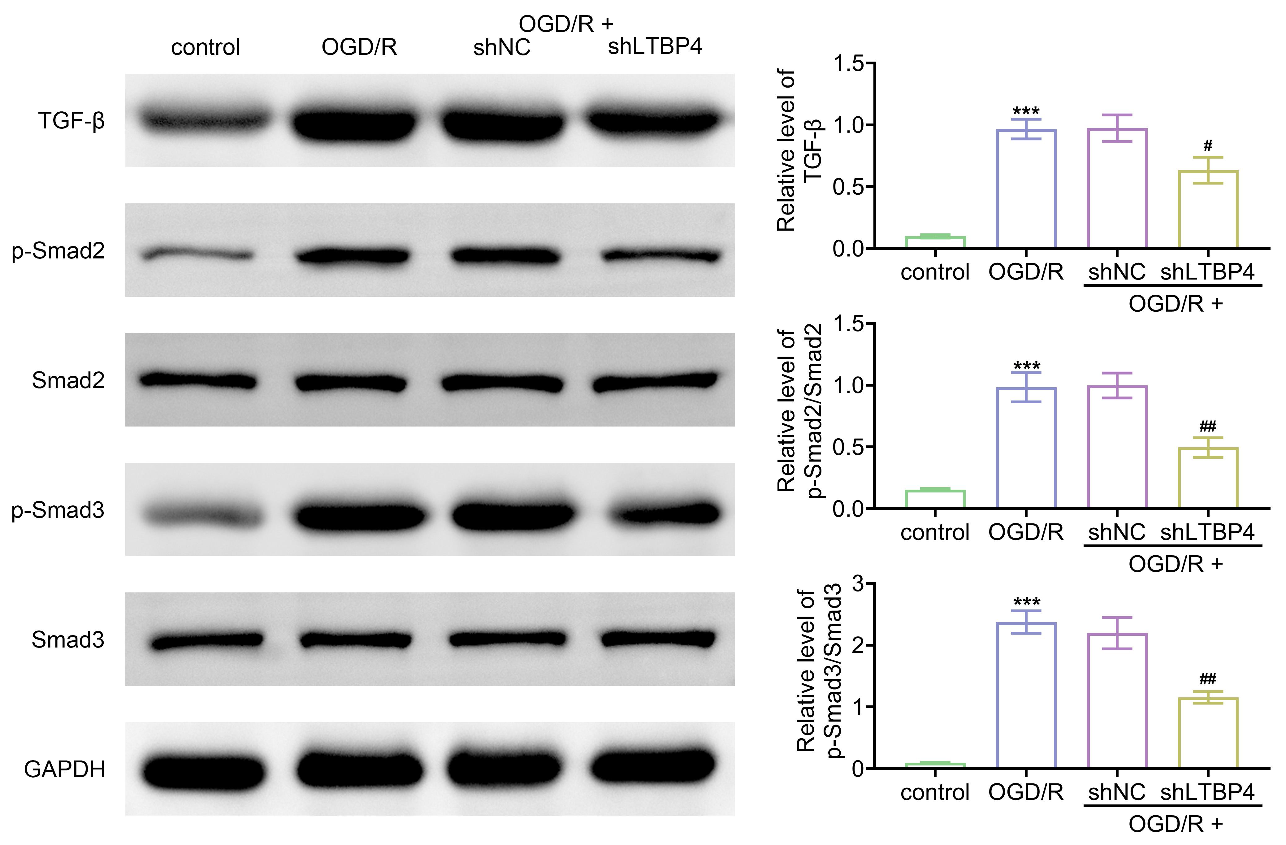 Downregulation of LTBP4 inhibits activation of the
TGF-β signaling pathway in cardiomyocytes. The cells were divided into
control, OGD/R, OGD/R + shNC, and OGD/R + shLTBP4 groups. Protein expression of
TGF-β, p-Smad2, Smad2, p-Smad3, and Smad3 was assessed by Western blot.
***p < 0.001 vs. control; ##p <
0.01, #p < 0.05 vs. OGD/R + shNC. OGD/R: oxygen-glucose
deprivation/reperfusion; shNC: Short hairpin negative control; LTBP4: Latent
transforming growth factor-beta binding protein 4; TGF-β: Transforming
growth factor-β; GAPDH: glyceraldehyde-3-phosphate dehydrogenase; Smad2:
mothers against decapentaplegic homolog 2.