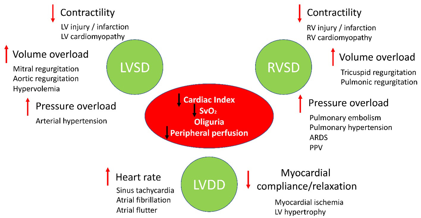 Leading triggers and pathophysiology of LCOS. Adapted from 
Lomivorotov et al. [13]. LVSD: left ventricular systolic dysfunction; 
RVSD: right ventricular systolic dysfunction; LVDD: left ventricular diastolic 
dysfunction; LV: left ventricle; RV: right ventricle; ARDS: acute respiratory 
distress syndrome; PPV: positive pressure ventilation; SvO2: mixed venous 
oxygen saturation.