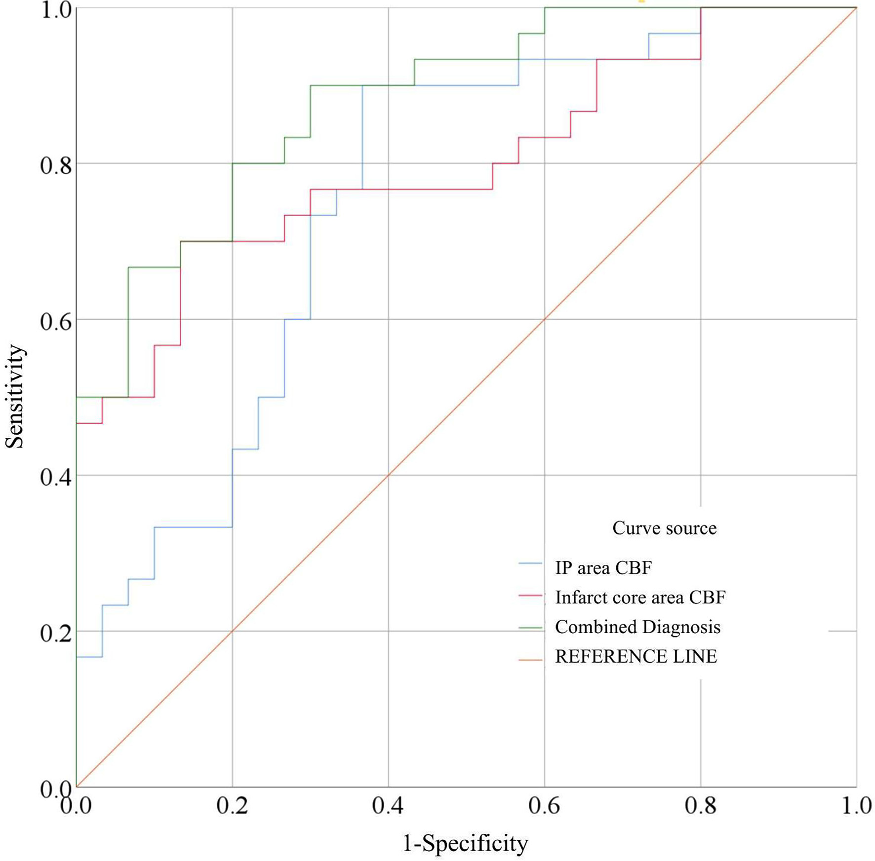 ROC curve for predicting poor prognosis using CBF values from
3D-ASL imaging. CBF: cerebral blood flow; IP: ischemic penumbra.