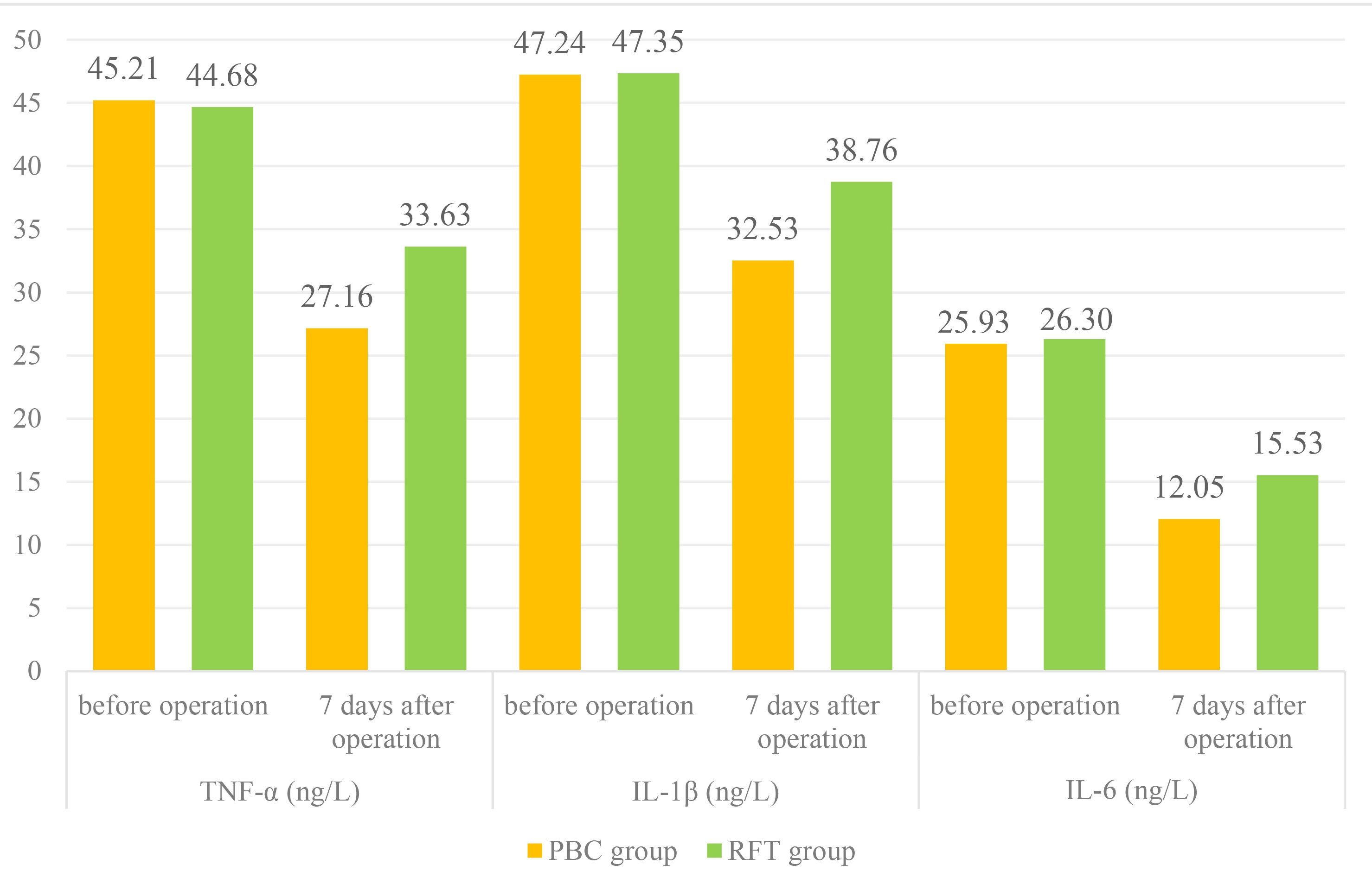 Comparison of inflammatory response indicators. TNF-α:
Tumor necrosis factor-alpha; IL-1β: Interleukin-1β; IL-6:
interleukin-6; PBC: Percutaneous balloon compression; RFT: Radiofrequency
thermocoagulation.