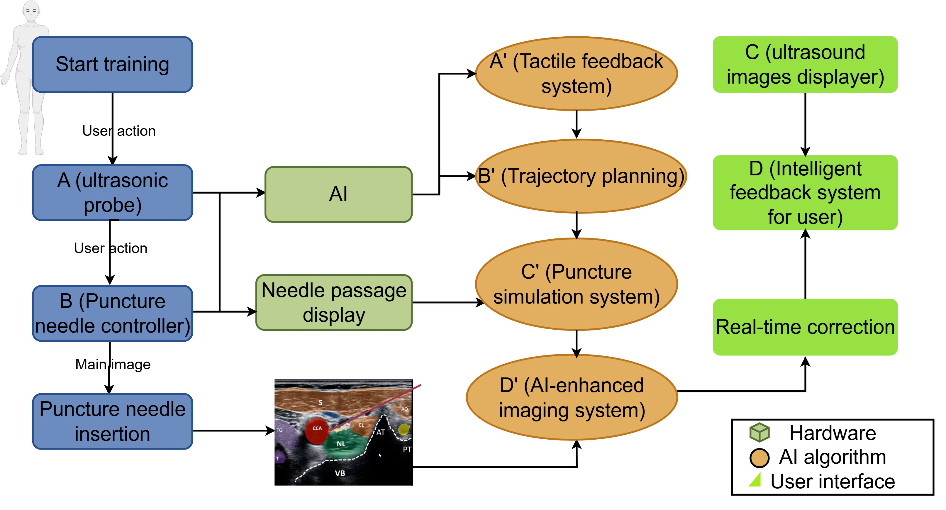 Conceptual diagram of the AI-enhanced UGRA simulation platform. This schematic illustrates the integrated system components and their 
interactions, designed to create an immersive training environment for 
ultrasound-guided regional anesthesia (UGRA). The platform bridges the gap 
between virtual practice and clinical application through four key components: A 
(Haptic Probe): Simulates a real ultrasound probe, providing tactile feedback 
with force feedback technology to mimic resistance on different tissue surfaces. 
B (Needle Controller): Reproduces tissue resistance and puncture sensations 
during needle insertion, including realistic “breakthrough” feelings and safety 
mechanisms. C (Visual Display): Renders real-time ultrasound images enhanced with 
AI overlay, using color-coding to identify critical anatomical structures 
(e.g., nerves in blue, and vessels in red) and display needle trajectory 
guidance. D (User Interface): Provides performance metrics (e.g., 
accuracy, time, and angle deviation) and real-time corrective feedback, along 
with skill progression analysis and personalized training adjustments. The system 
integrates hardware, AI algorithms, and user interfaces to enable realistic 
simulation and effective skill development. AI: artificial intelligence; TG: 
Thyroid Gland; T: Trachea; S: Sternocleidomastoid; CCA: Common Carotid Artery; 
NL: Longus Colli Muscle; VB: Vertebral Body; CL: Clavicle; AT: Anterior 
transverse nodule; PT: Postternal nodule.